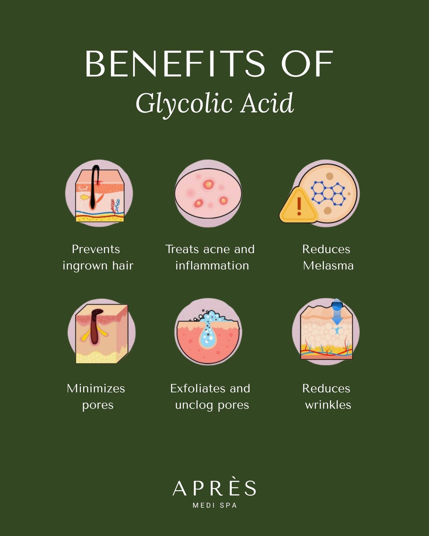 Glycolic Acid = your glow booster ✨
This powerhouse exfoliant helps smooth texture, fade dark spots, unclog pores, and reveal brighter skin!

#apresmedispa #glycolicacid #skincareeducation #estheticianlife #medispa