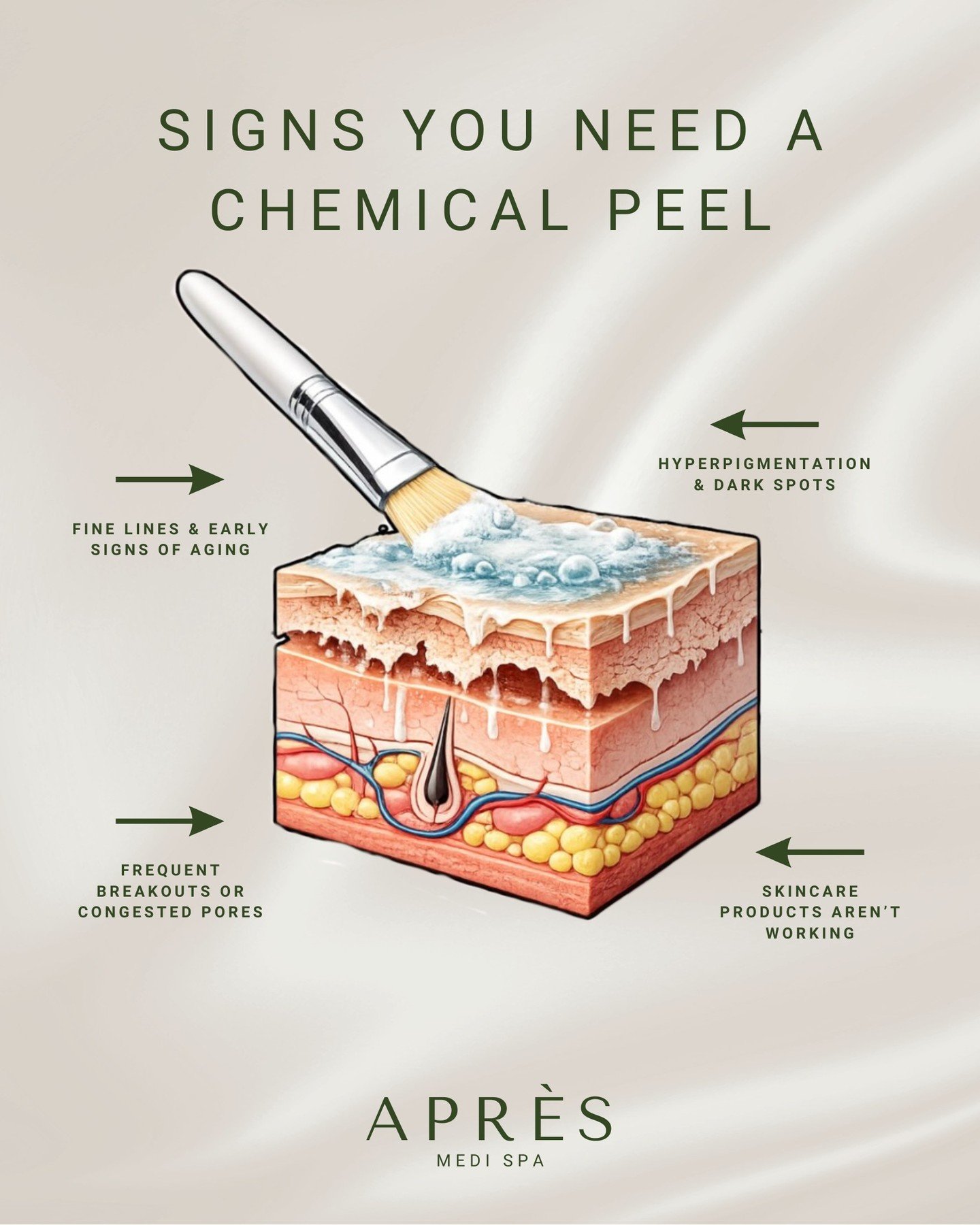 Your skin might be trying to tell you something&hellip; ✨

If you&rsquo;re noticing stubborn dark spots, frequent breakouts, or fine lines starting to settle in, it may be time to level up your skincare routine with a chemical peel.

Designed to exfo