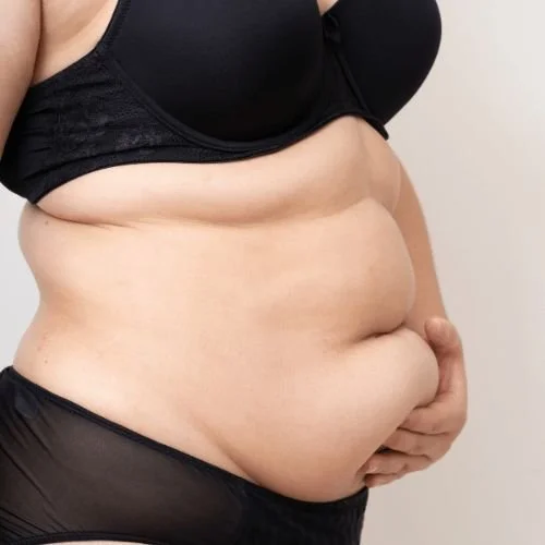 Stubborn Fat