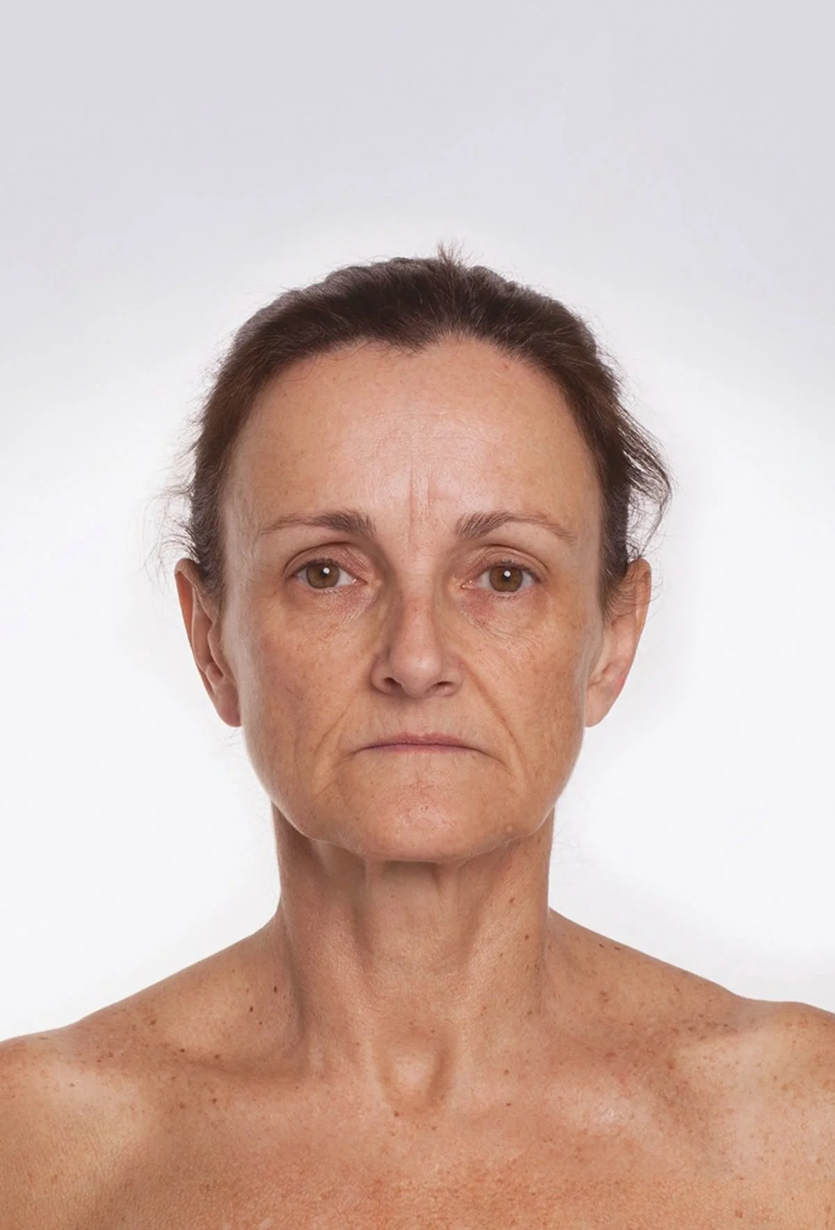 SAGGING AND LOOSE SKIN