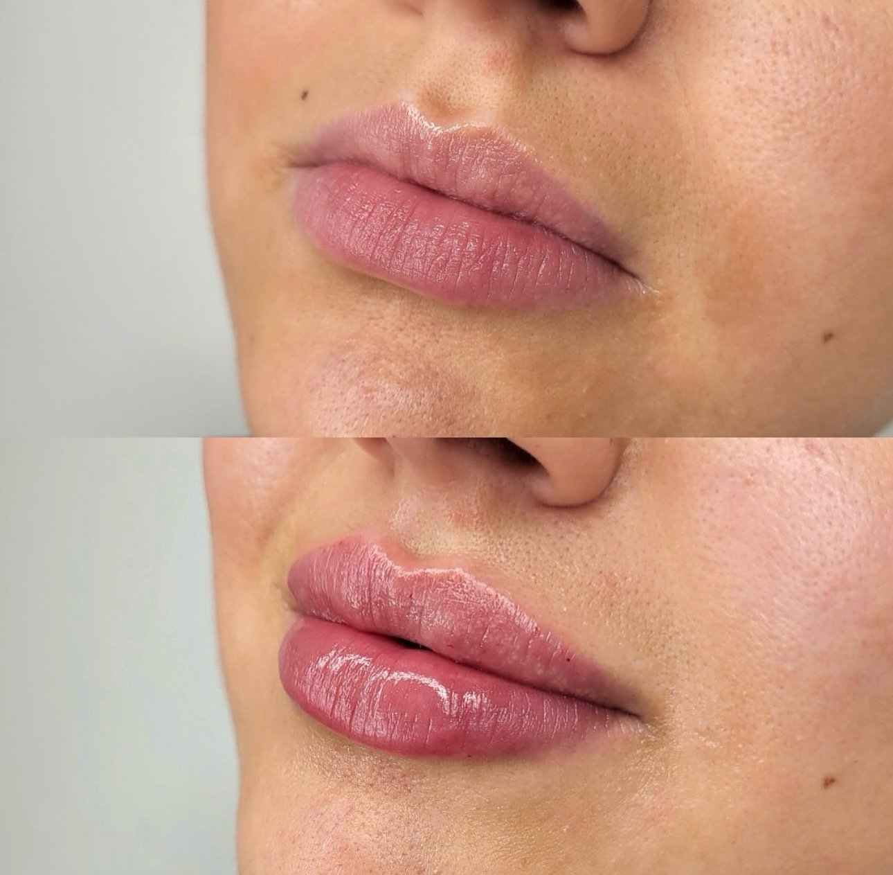 Close-up of a woman's lips, showing before and after lip gloss application, highlighting smooth, full lips with glossy finish.