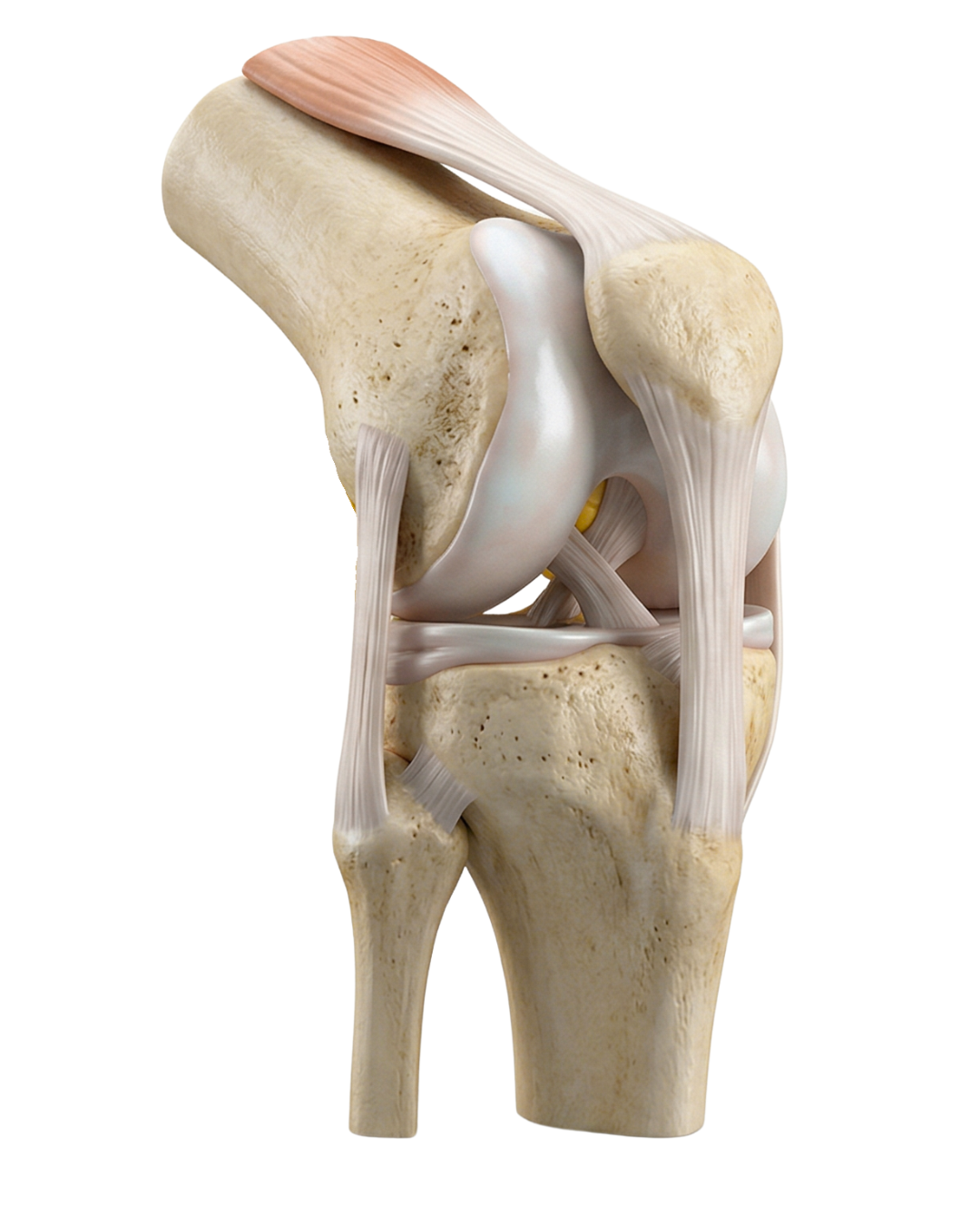 Knee Reconditioning Program