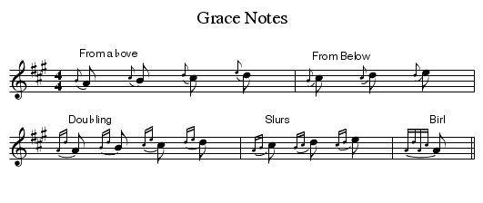 Pastor, Don’t Forget to Play the Grace Notes