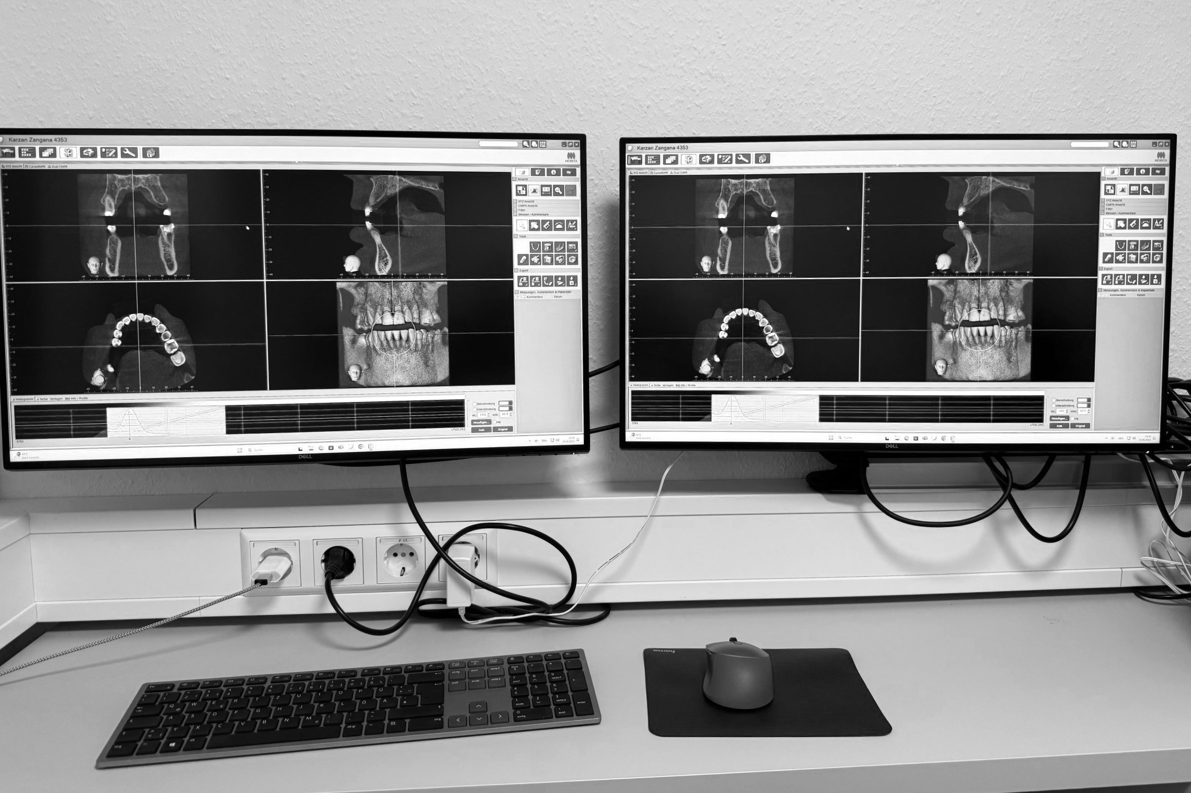 DVT,  digitale Volumentomographie 