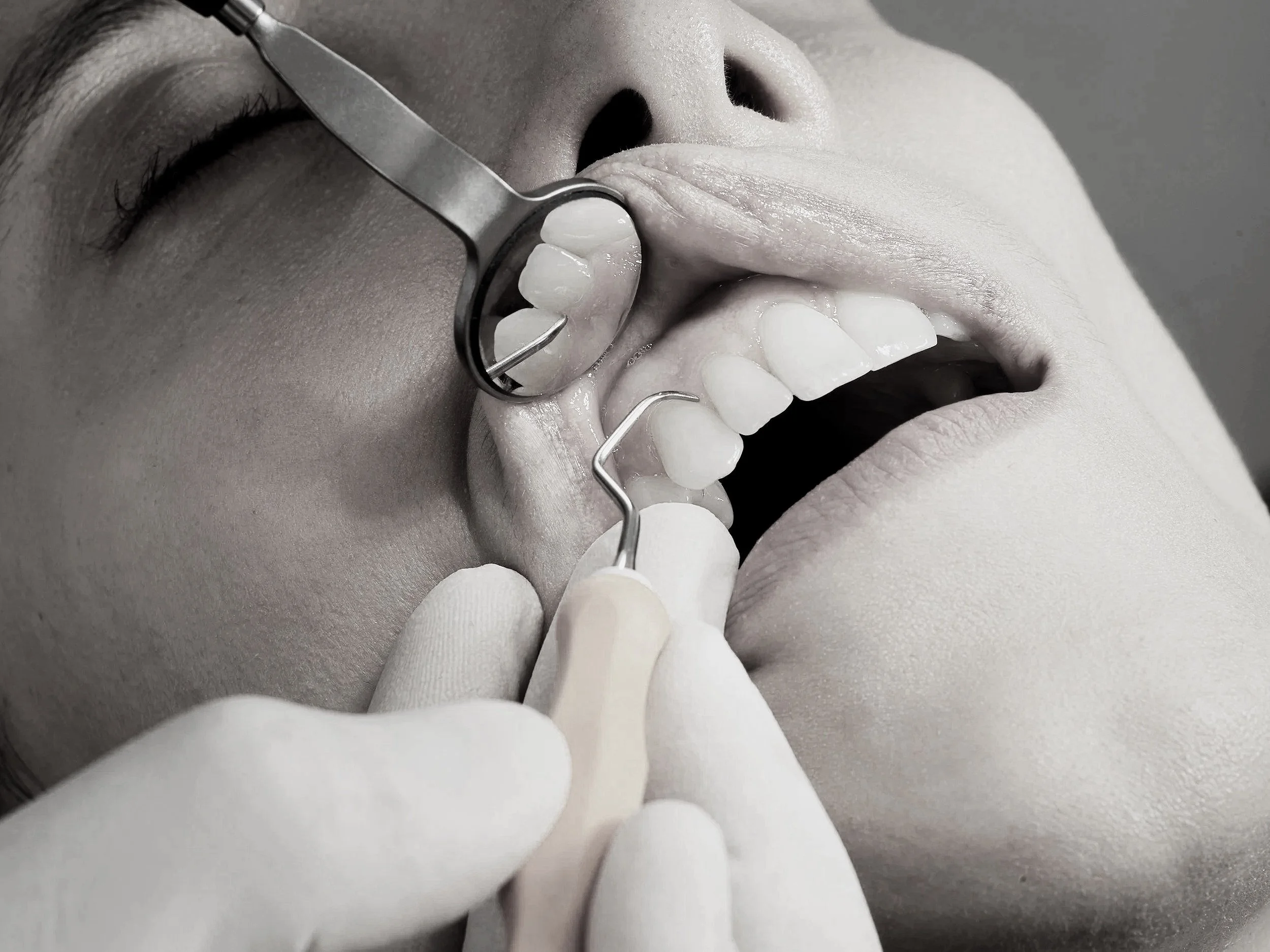 Close-up of a dentist examining a patient's teeth with a dental mirror and explorer