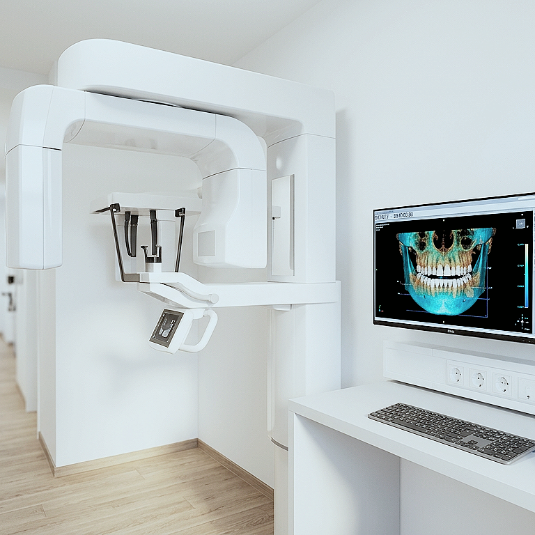 Ilustrație: aparat DVT cu analizarea unei radiografii 3D pe computer