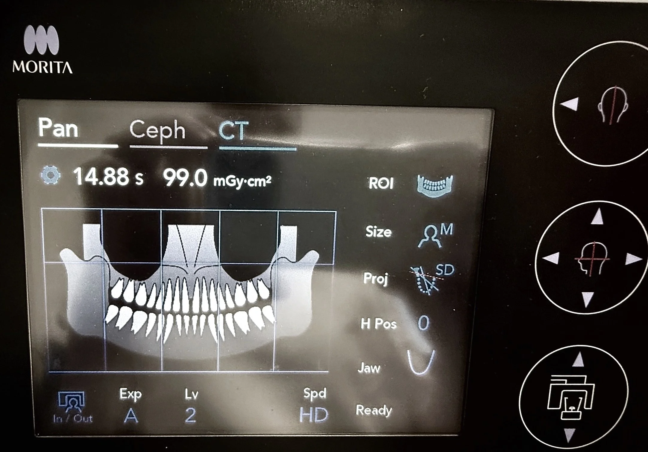 digitale Volumentomographie (DVT), Laser-Mikrochirurgie