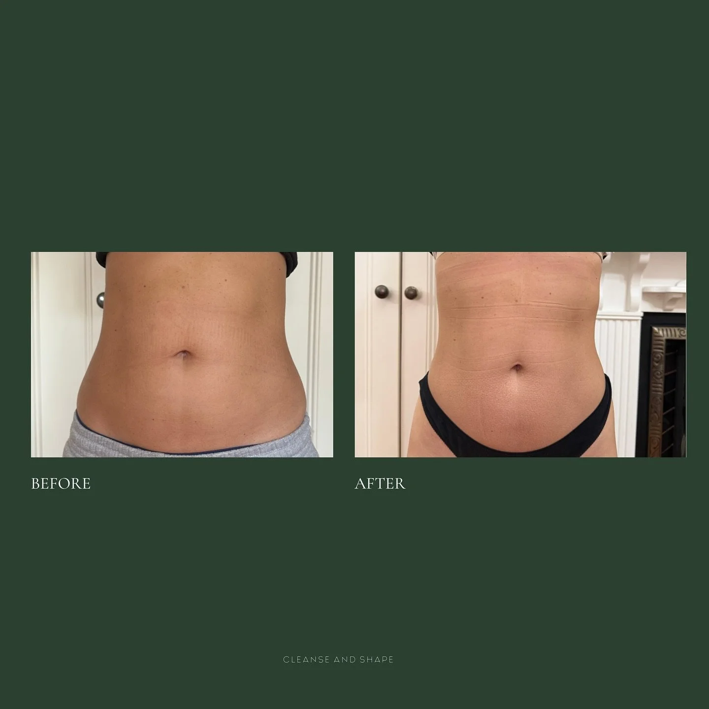 Only 6 weeks apart and the shift speaks for itself.

This client already had a strong routine and a healthy lifestyle. But she knew that sometimes, effort alone isn&rsquo;t enough, especially when your body is holding on to inflammation or tension th