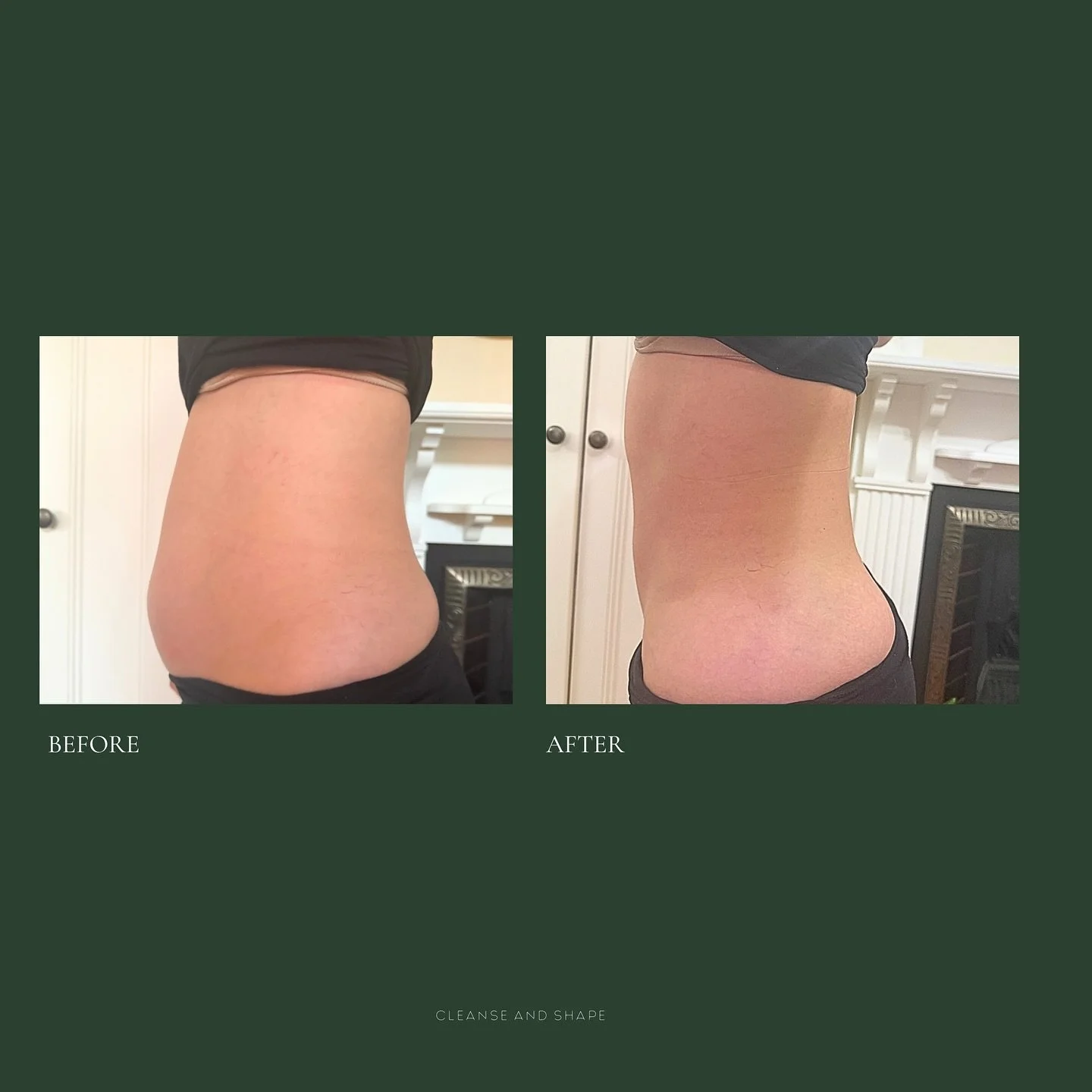 This is after just one session of our Ultimate Core Makeover: Cleanse and Shape Blueprint. Yes, one.

We combine award-winning technology with over five years of hands-on experience to get results like this. Not by chance, but through deep understand