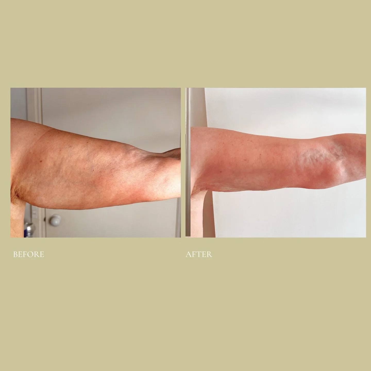 While we&rsquo;re known for our core makeovers and face and jaw transformations, we also treat other areas using our Cleanse and Shape signature techniques.

Our treatments use a thoughtfully blended approach, combining multiple non-invasive modaliti