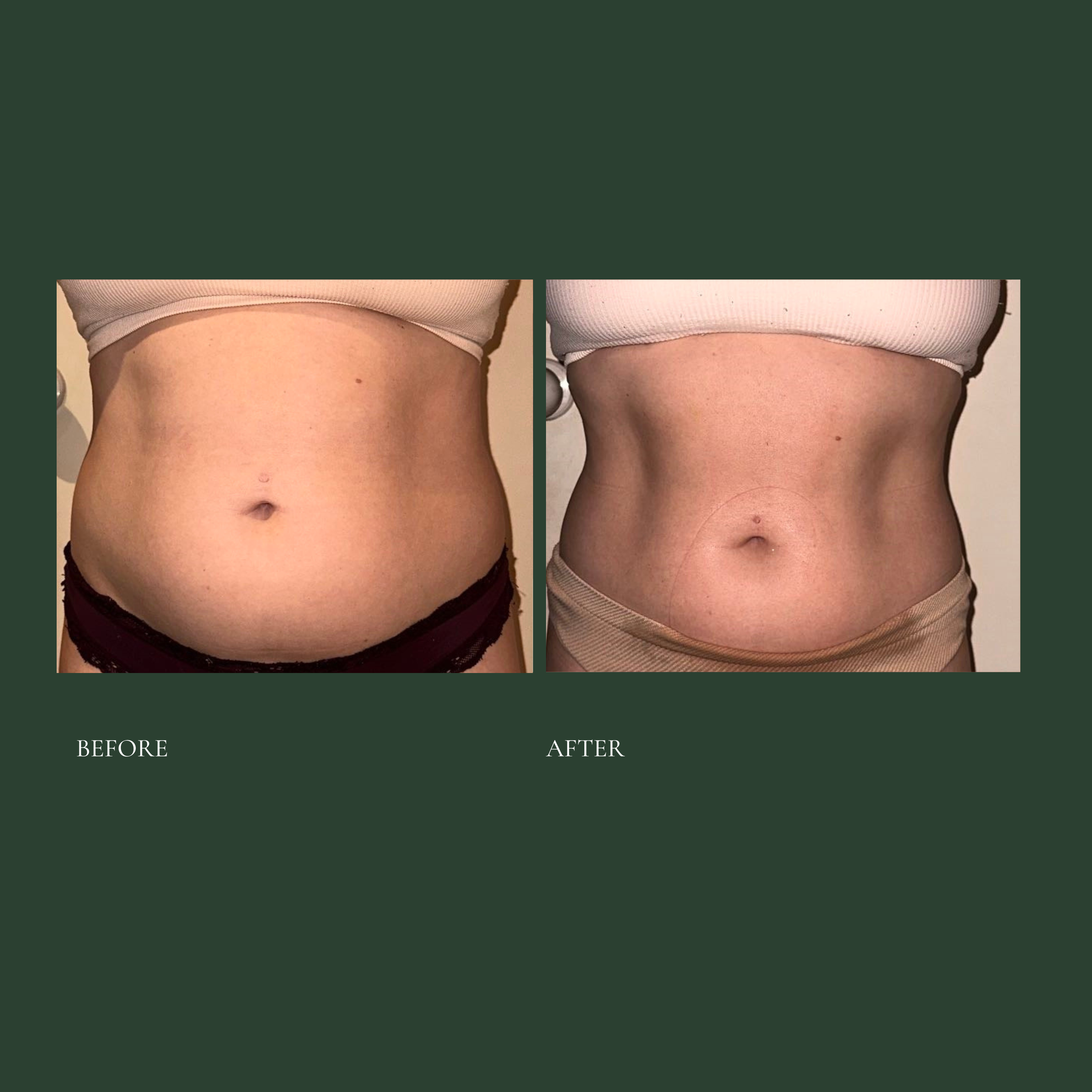 Cleanse and shape (Instagram Post) 2.png.PNG