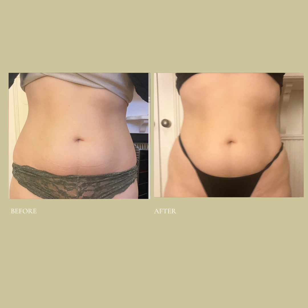 Cleanse and shape (Instagram Post) 14.PNG