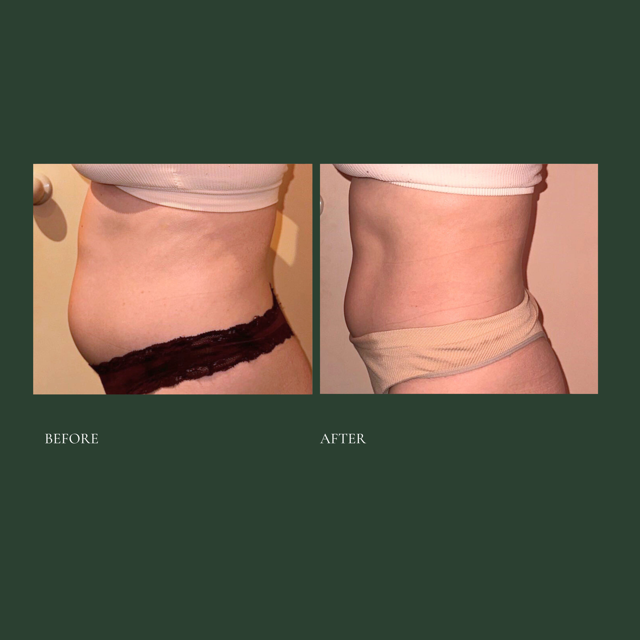 Cleanse and shape (Instagram Post) 3.png.PNG