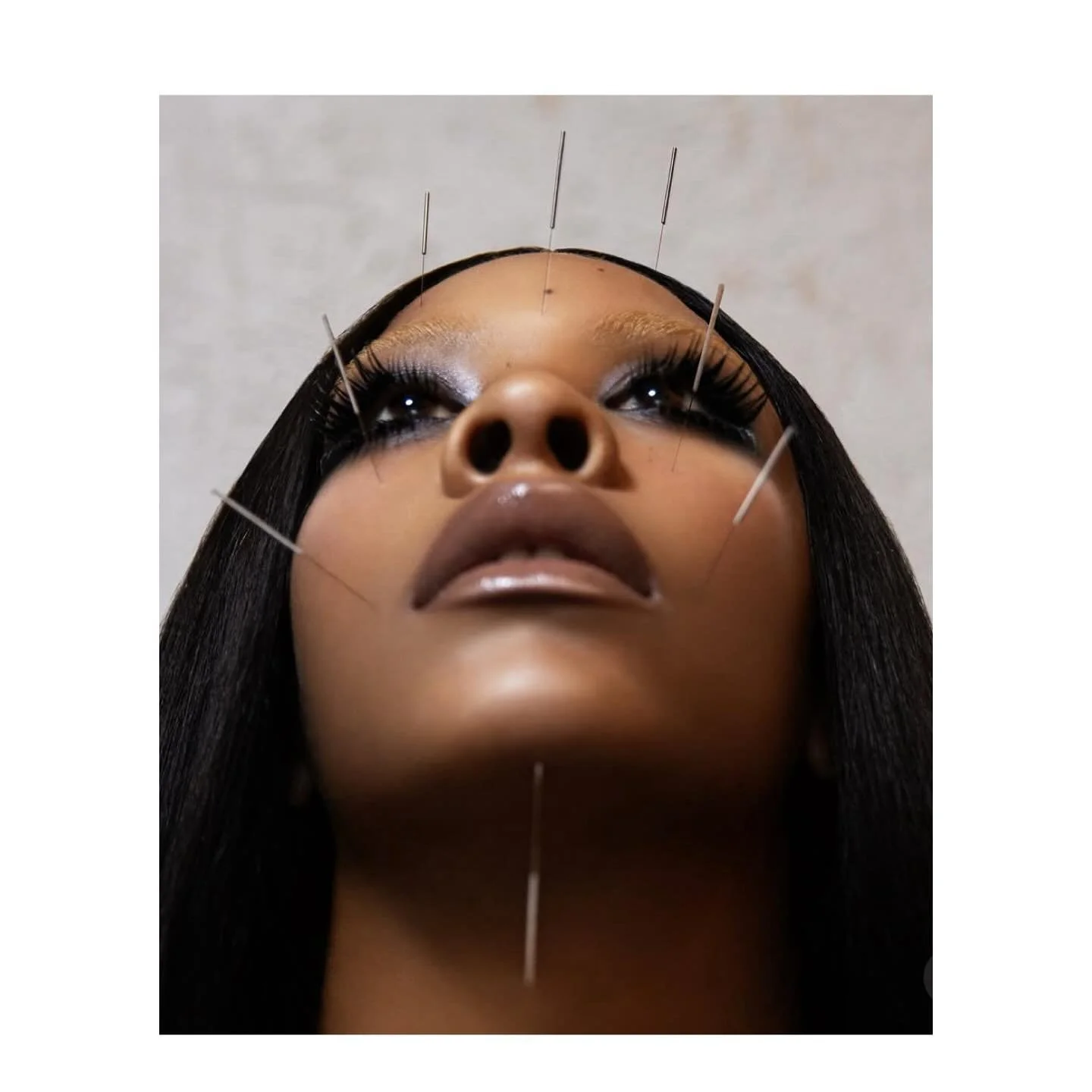 When @riconasty turns Acupuncture into art ❤️