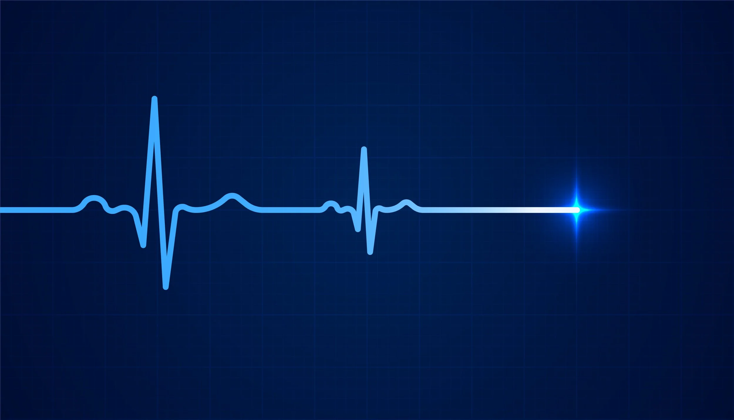 An blue image of an electrocardiogram