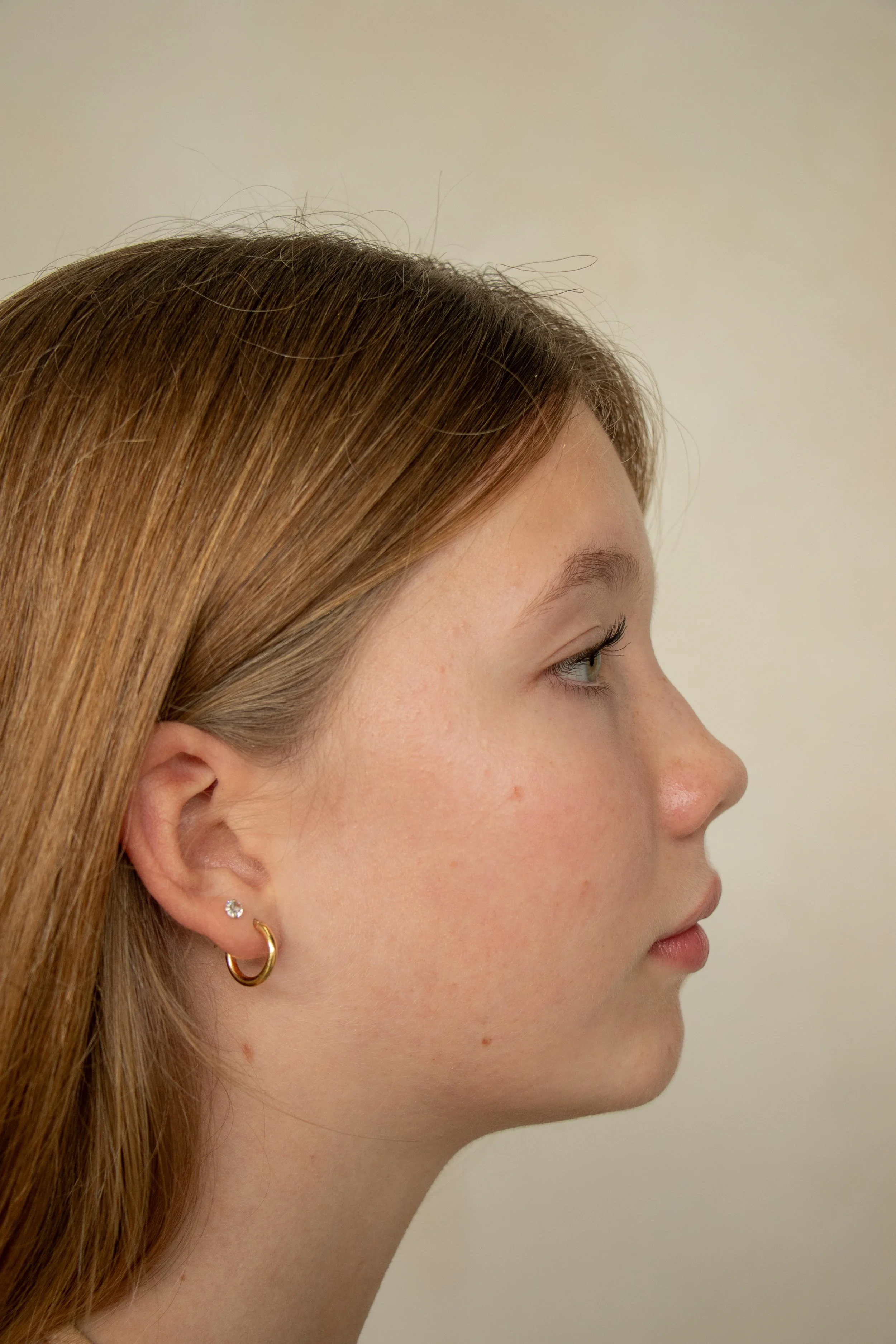 YoungSkin-107.jpg