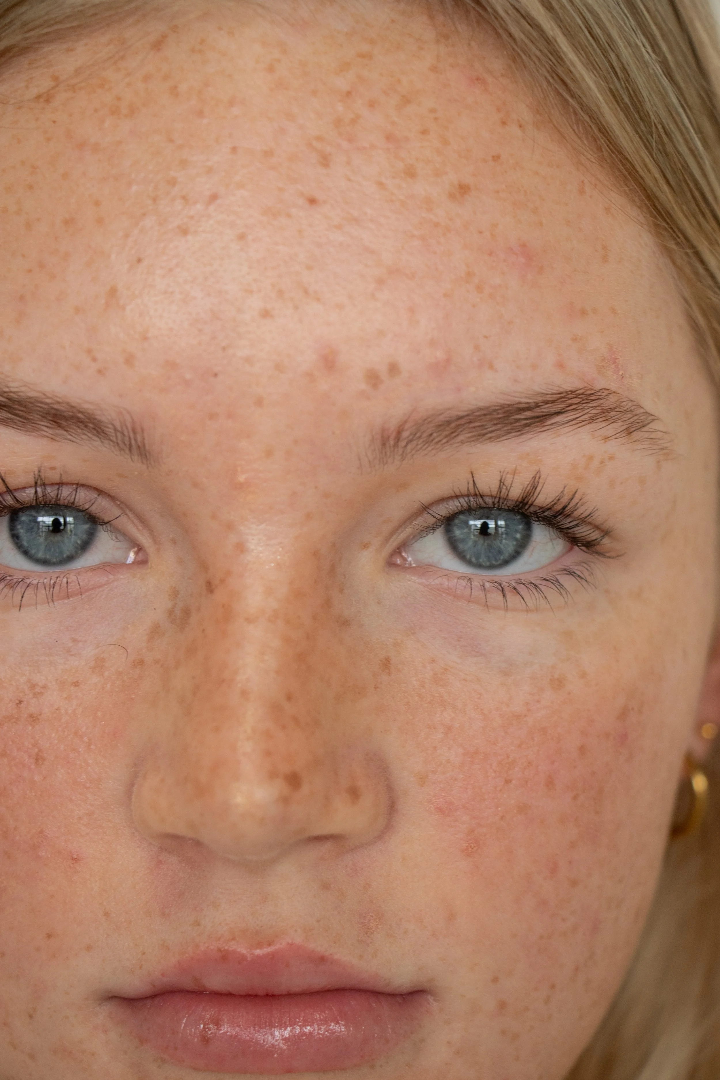 YoungSkin-051.jpg