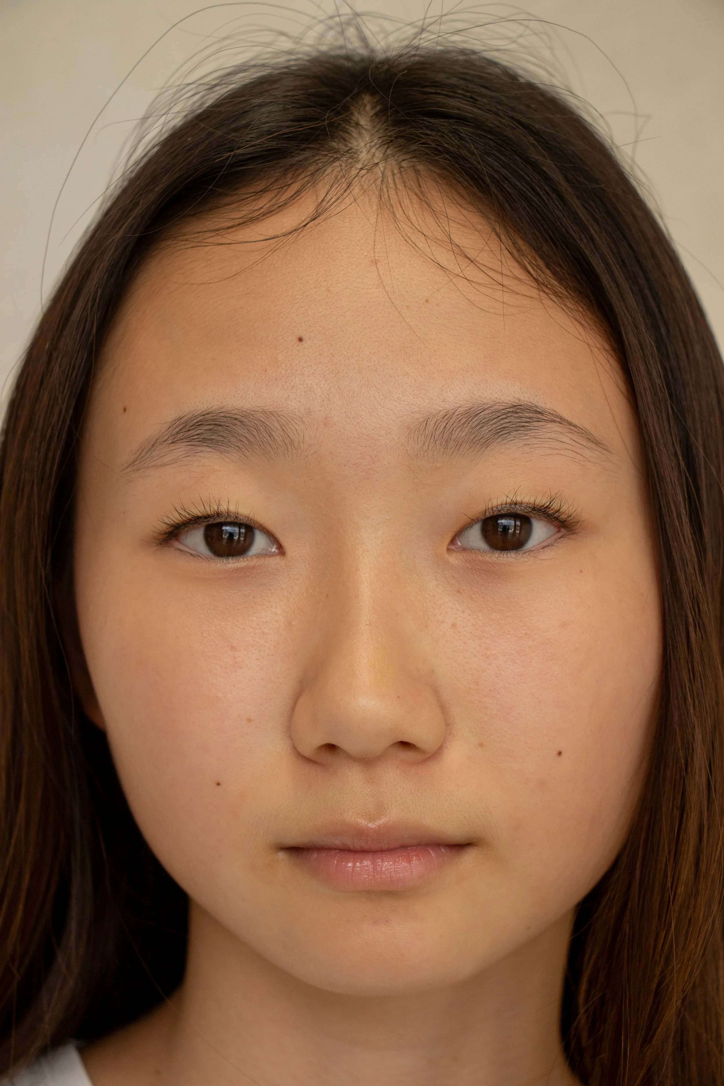 YoungSkin-066.jpg