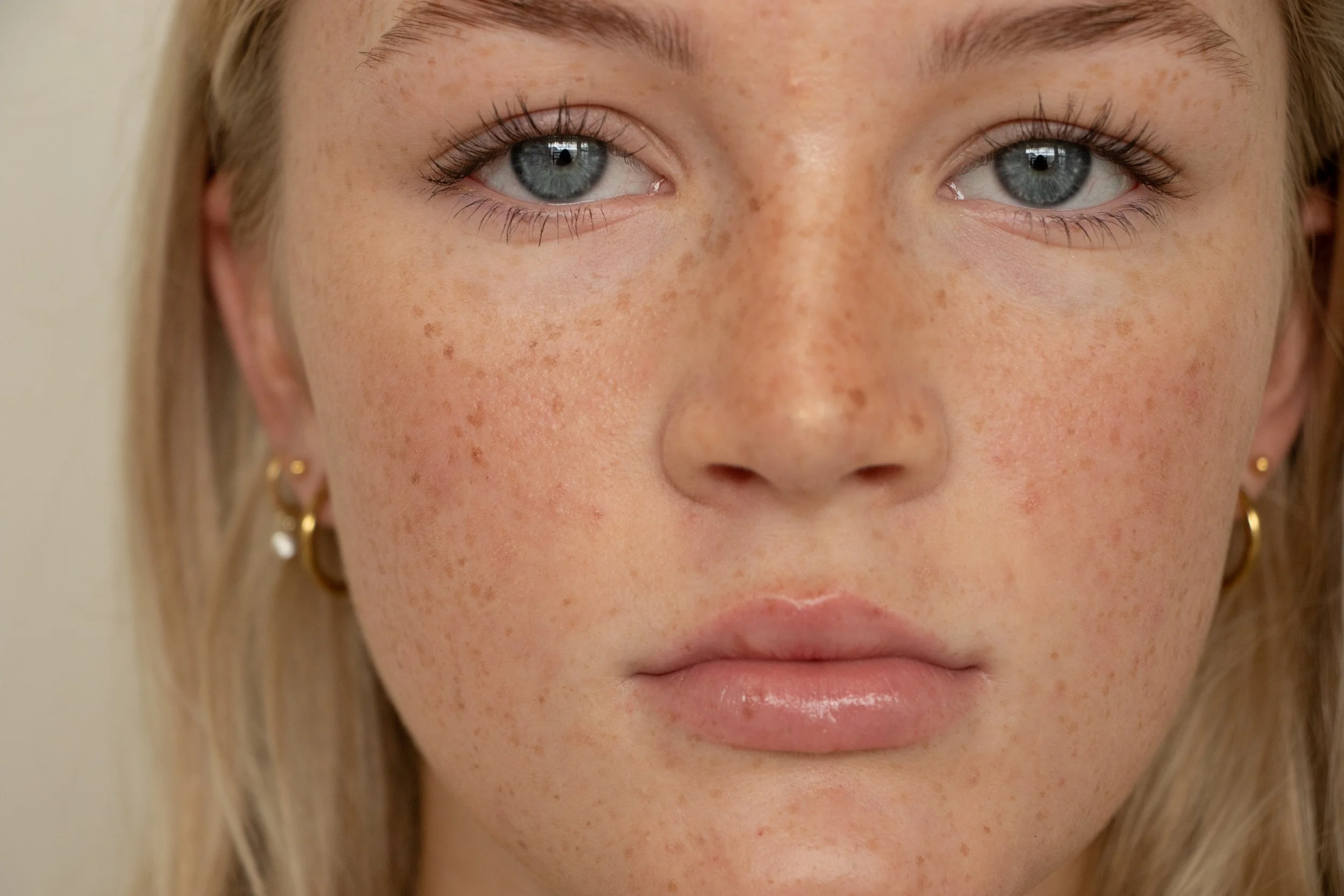 YoungSkin-053.jpg
