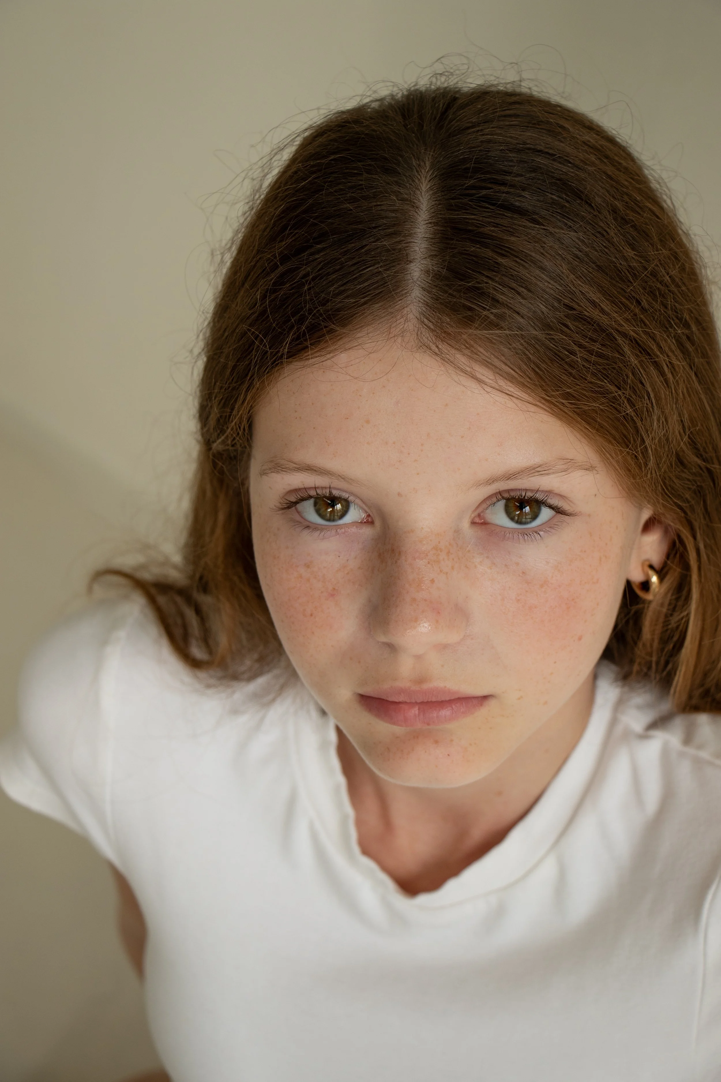 YoungSkin-159.jpg