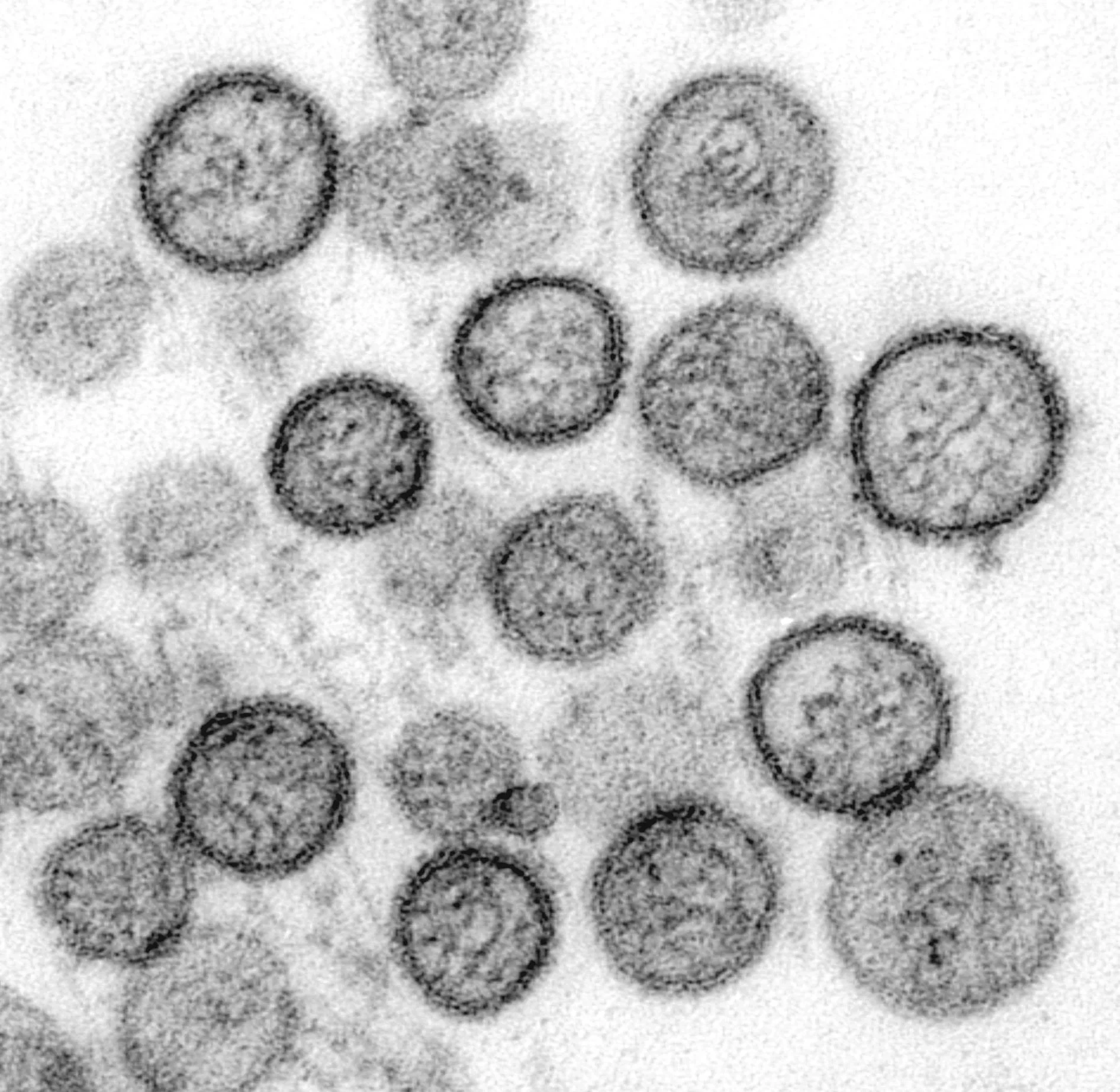An electron micrograph showing particles of the Hantavirus, the causative agent of Hantavirus Pulmonary Syndrome (HPS).