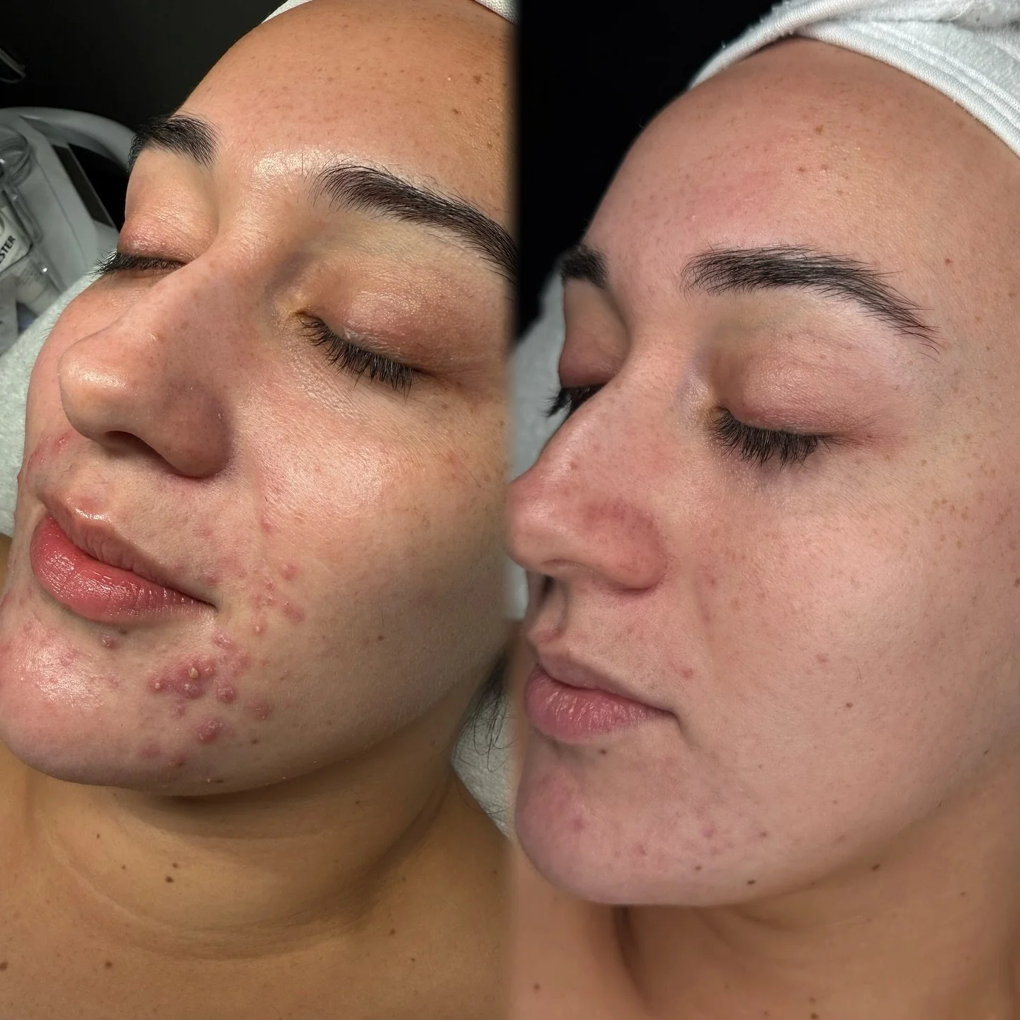 ✨ Healthy, confident skin is a journey &mdash; and we&rsquo;re here for every step of it. ✨

From acne and rosacea to ageing and barrier repair, our skin treatments are all results driven. Every plan is created to support your skin&rsquo;s unique nee