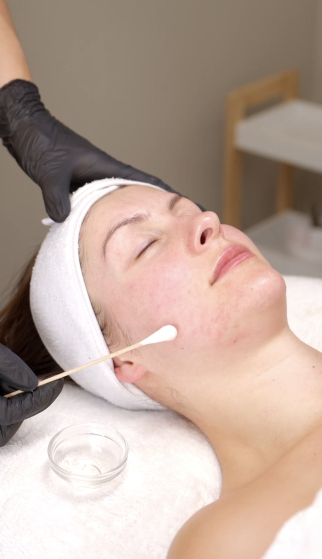Skin Peels, Microneedling &amp; Skin Needling in Christchurch: How to Improve Your Skin in 2026