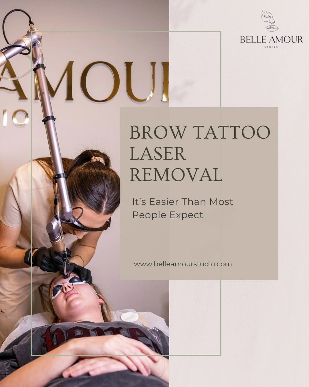 ✨ Thinking about removing old brow tattoo pigment? ⚡️ 

If your brows have turned ashy, grey, blue, purple, red, yellow, or no longer suit your face, Laser or Saline removal is often much easier and faster than people expect. 

Many clients see visib