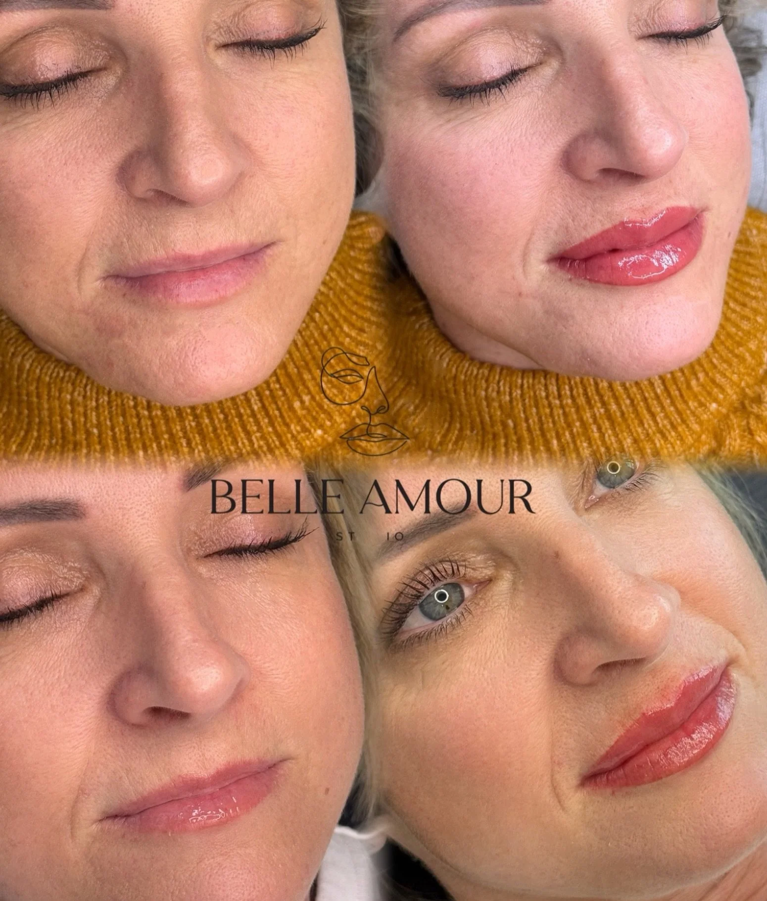 Realistic Lip Blush results &amp; immediately after tattooing 👄 

See the: before, immediately after tattooing, healed post FIRST session, and after our touch up 💋 

Lip blush heals incredibly soft and natural when done correctly &amp; not over sat