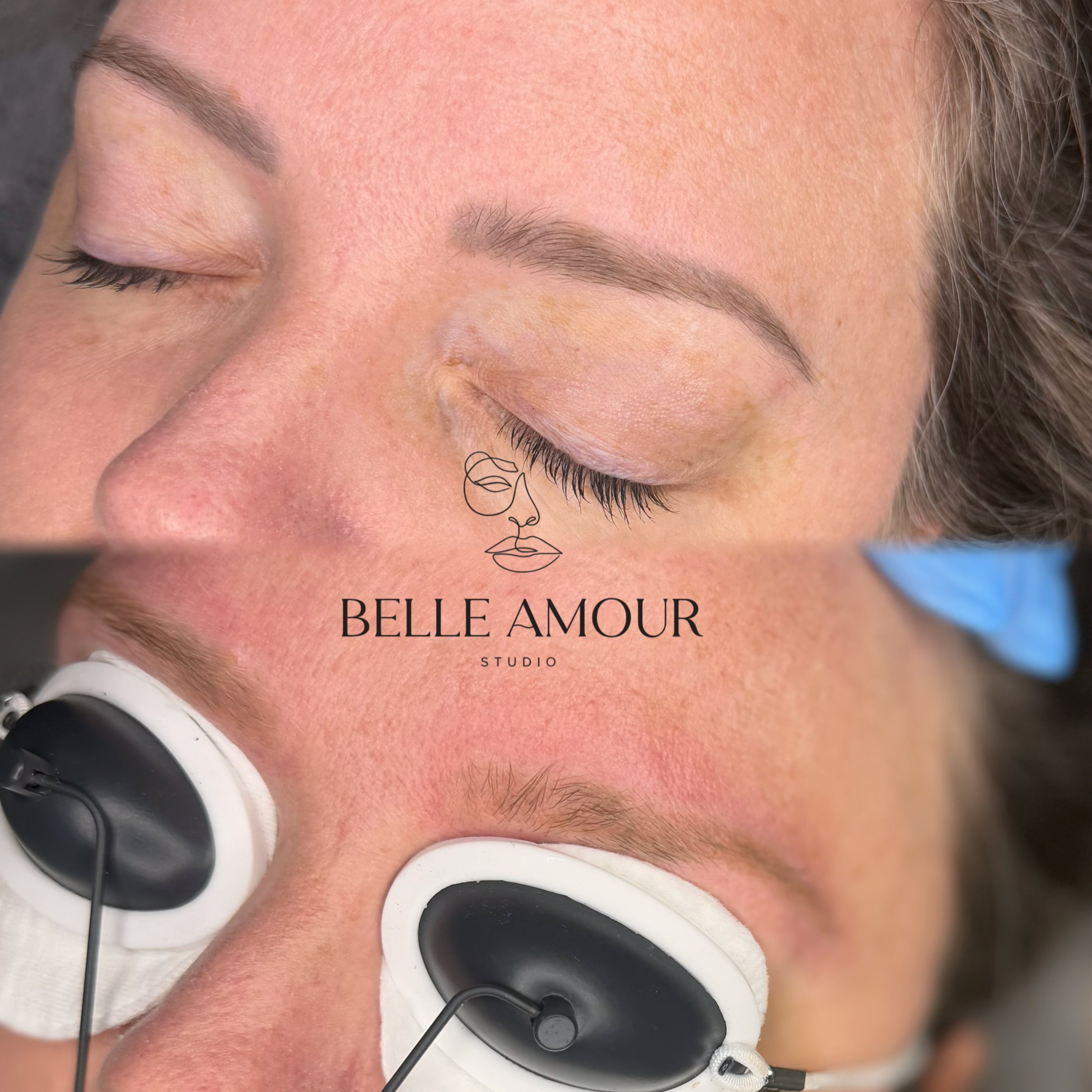 Cosmetic eyebrow tattoo laser removal in Christchurch by experienced cosmetic tattoo artist Samantha at Belle Amour Studio.