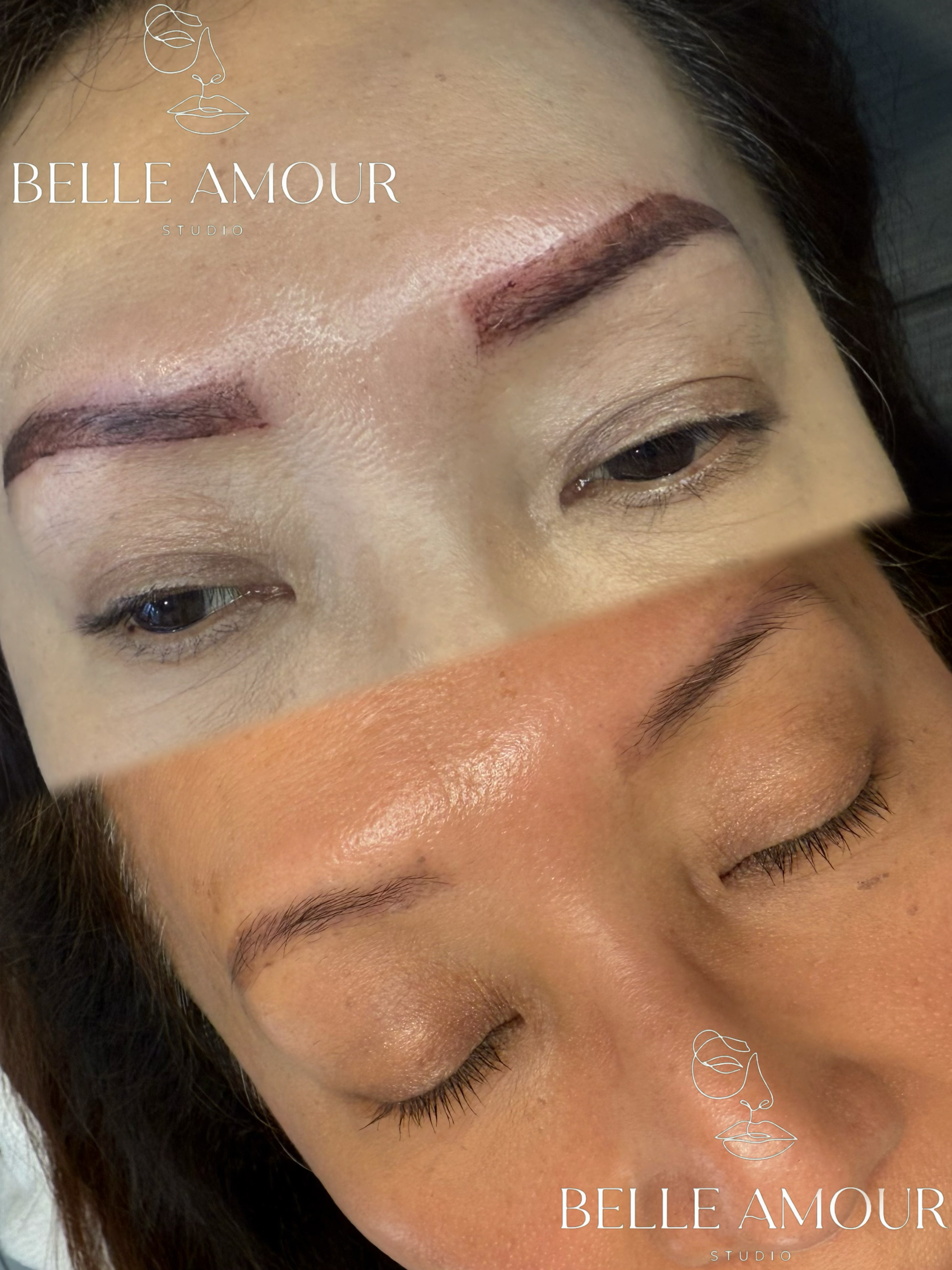 Gentle saline eyebrow tattoo removal service in Christchurch for natural-looking results