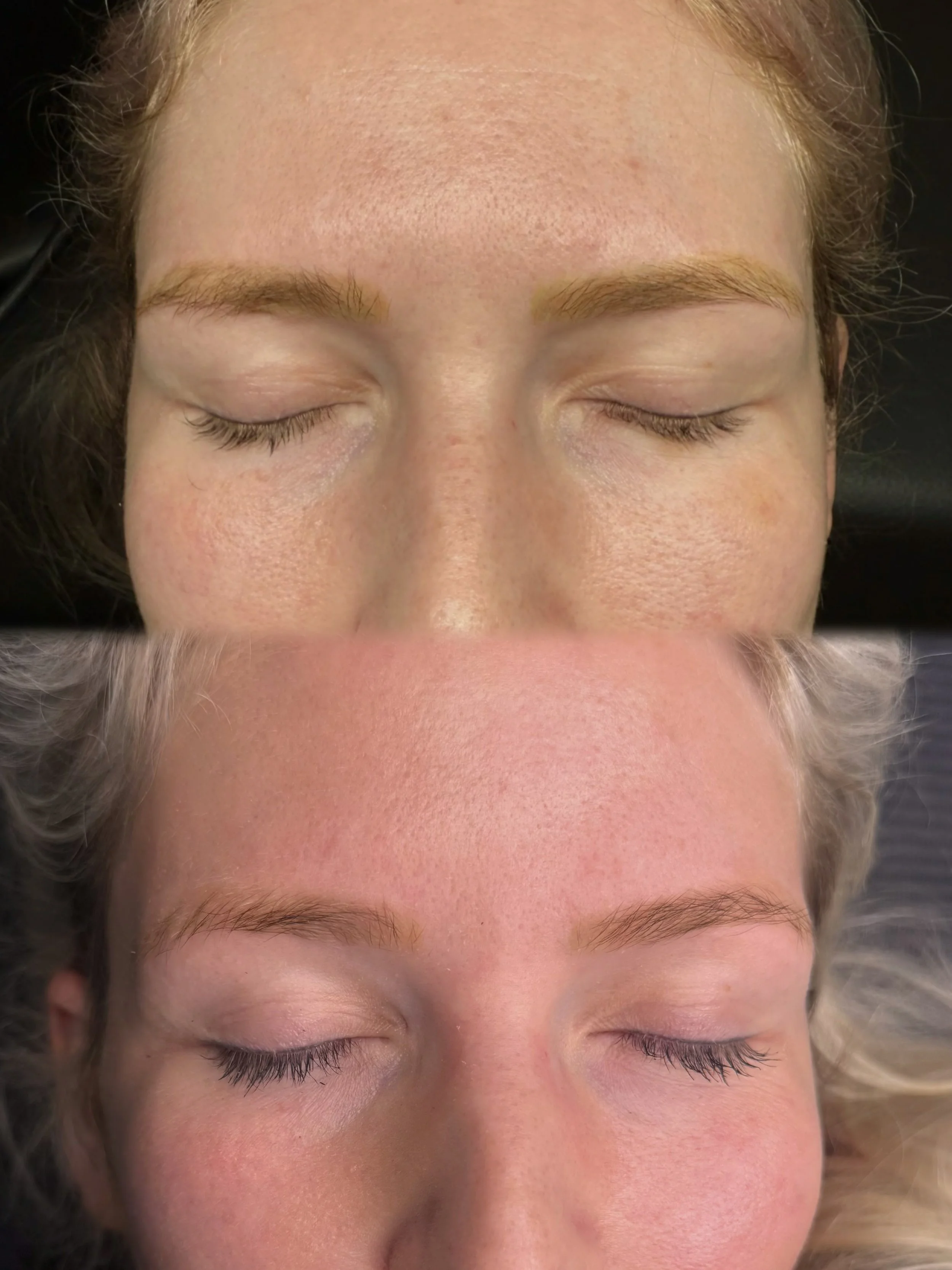 Pico laser eyebrow tattoo removal Christchurch treatment at Belle Amour Studio for targeted fading of unwanted brow pigment.