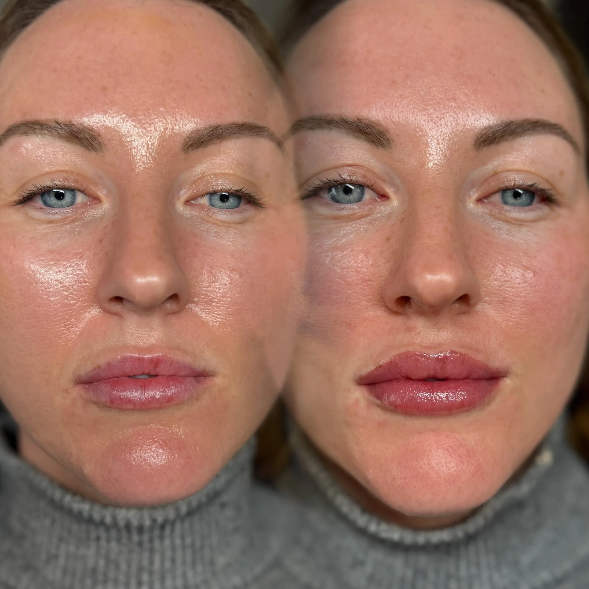 Belle Amour Studio lip blush tattoo results with soft natural looking colour.