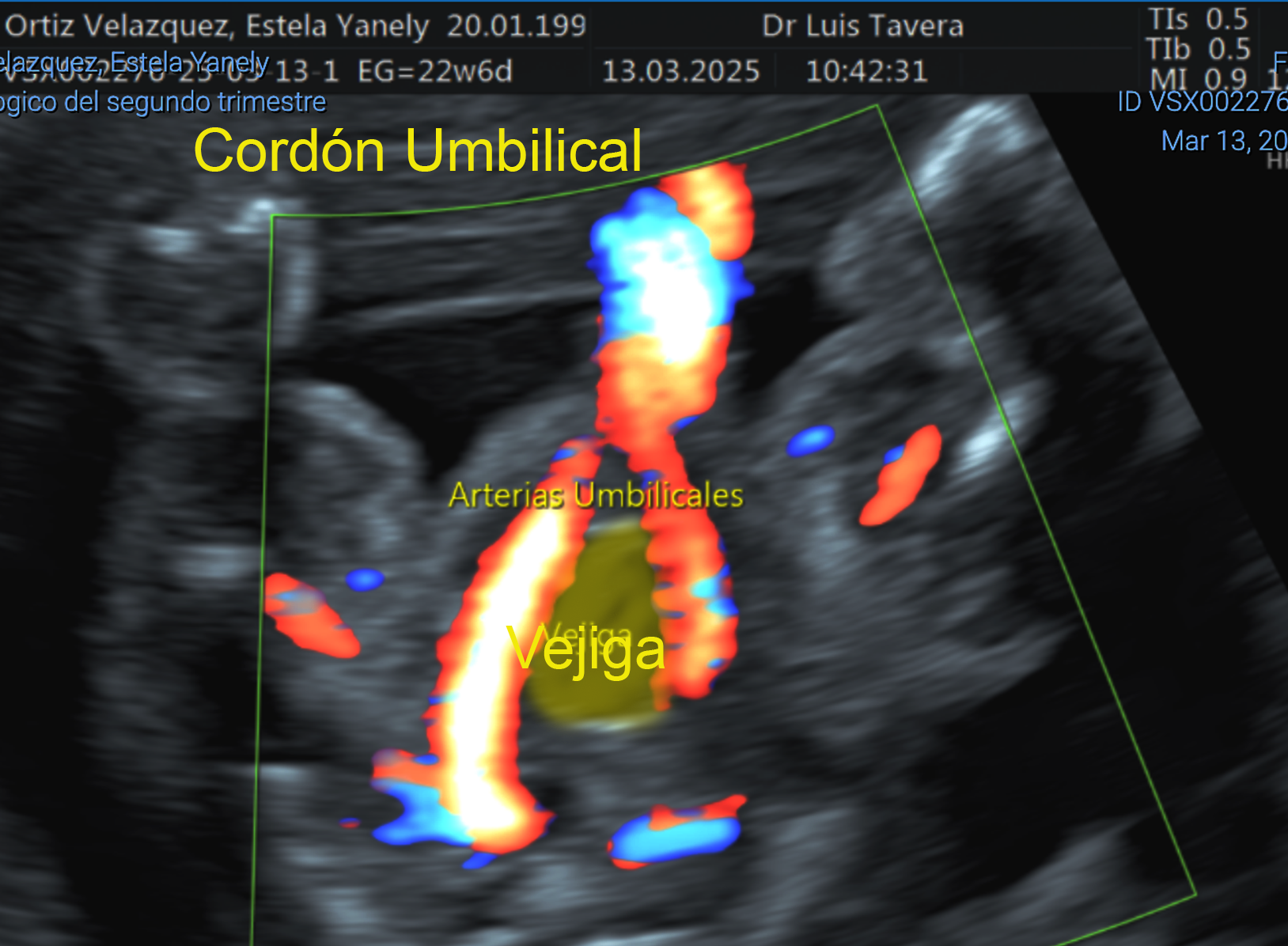 arterias umbilicales.png