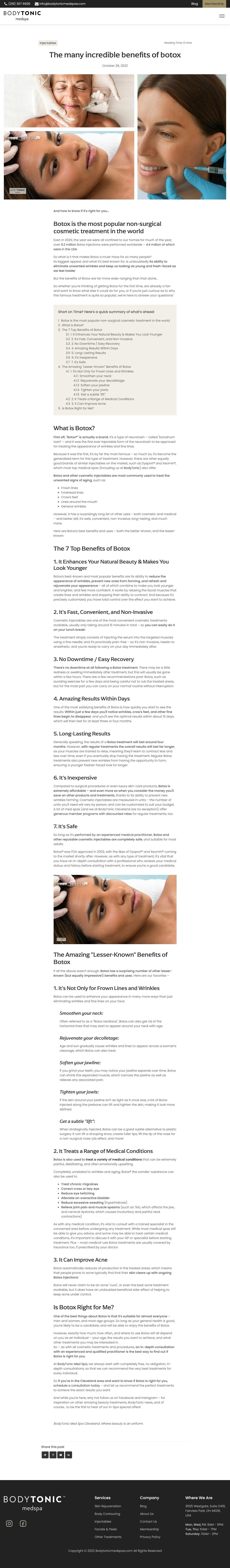 2022-10+Blog+-+Benefits+of+Botox.jpg