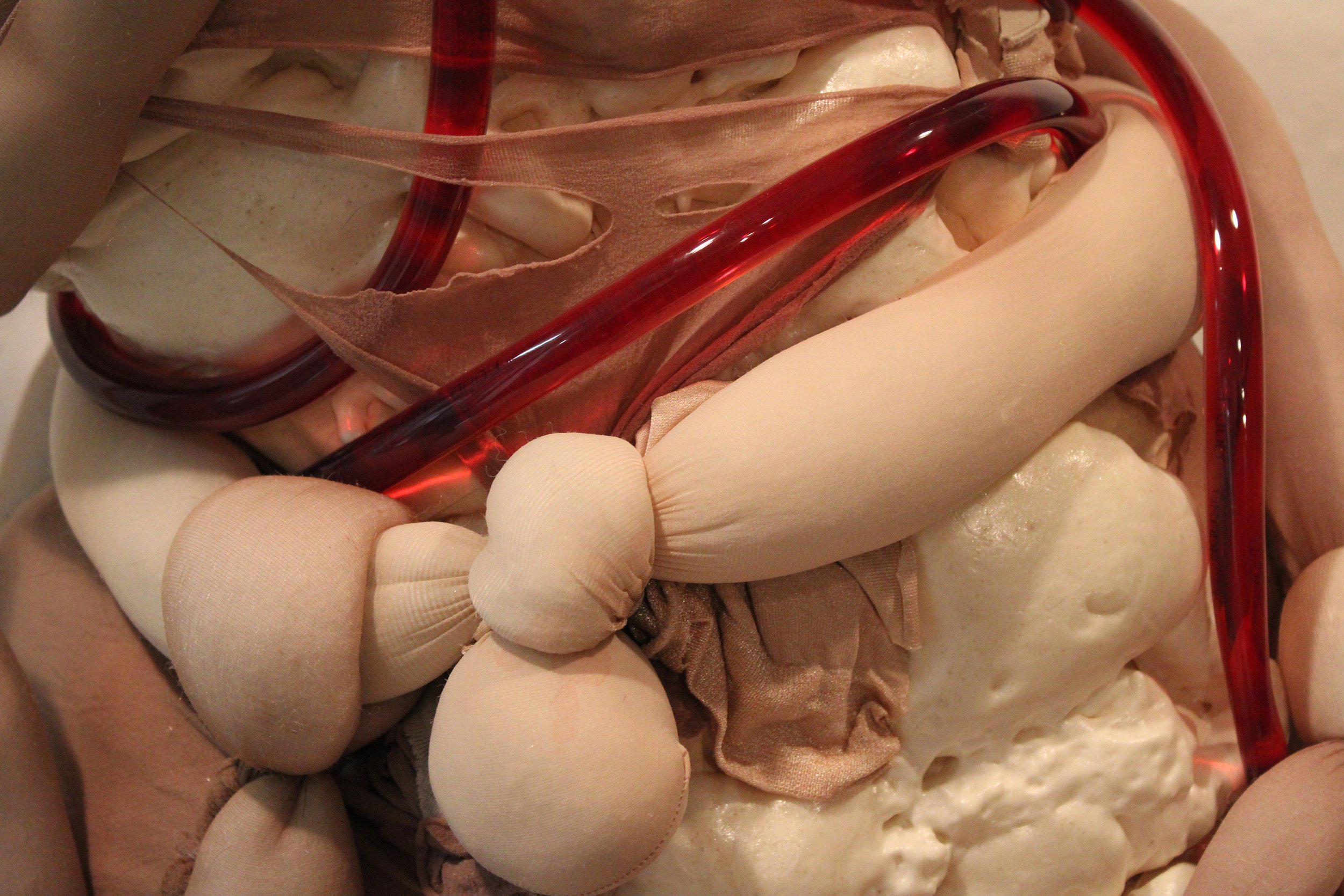 Dysmorphic Figure