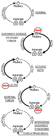 A diagram of different kinds of Cushing's syndrome