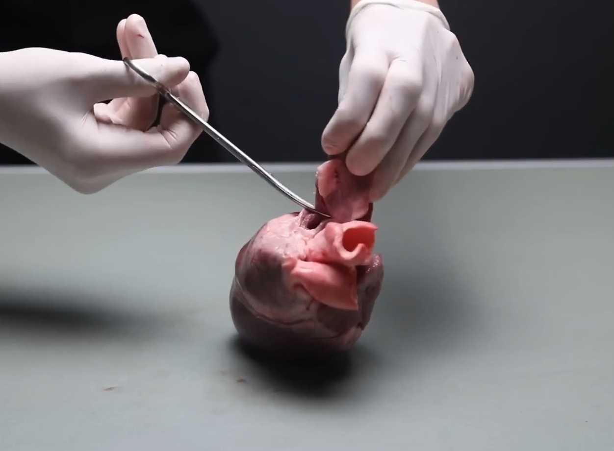 Rape of the heart - 2025