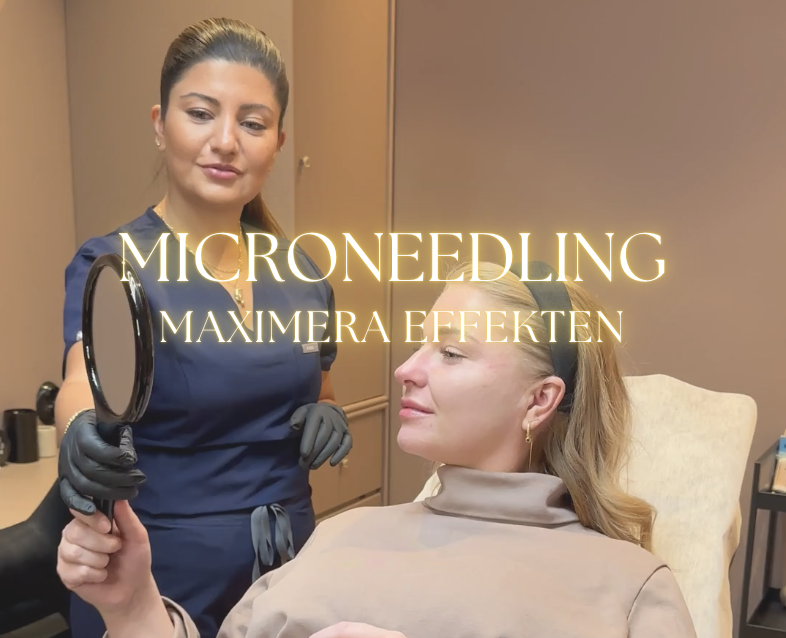 Microneedling + Lax-DNA eller Exosomer för en magisk hudförnyelse