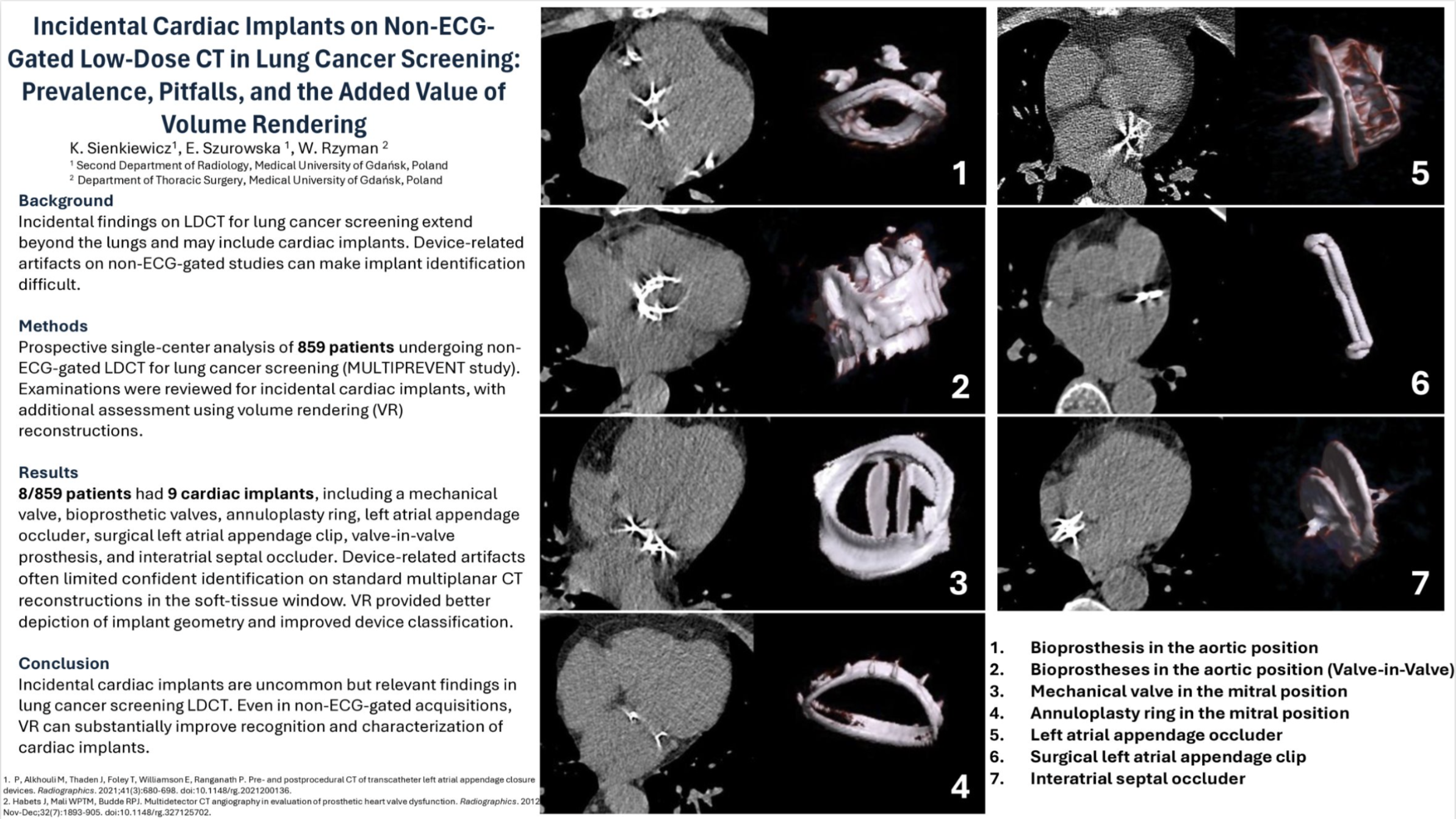 Incidental Cardiac Implants on Non-ECG Gated Low-Dose CT in Lung Cancer Screening: Prevalence, Pitfalls, and the Added Value of Volume Rendering | Katarzyna Sienkiewicz - Second Department of Radiology, Medical University of Gdansk, Poland