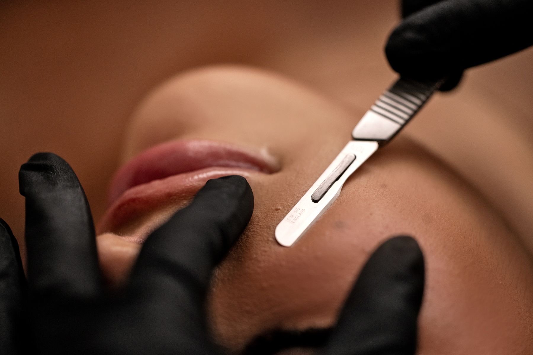 Dermaplaning in Albuquerque: Smooth, Glowing Skin Without Downtime