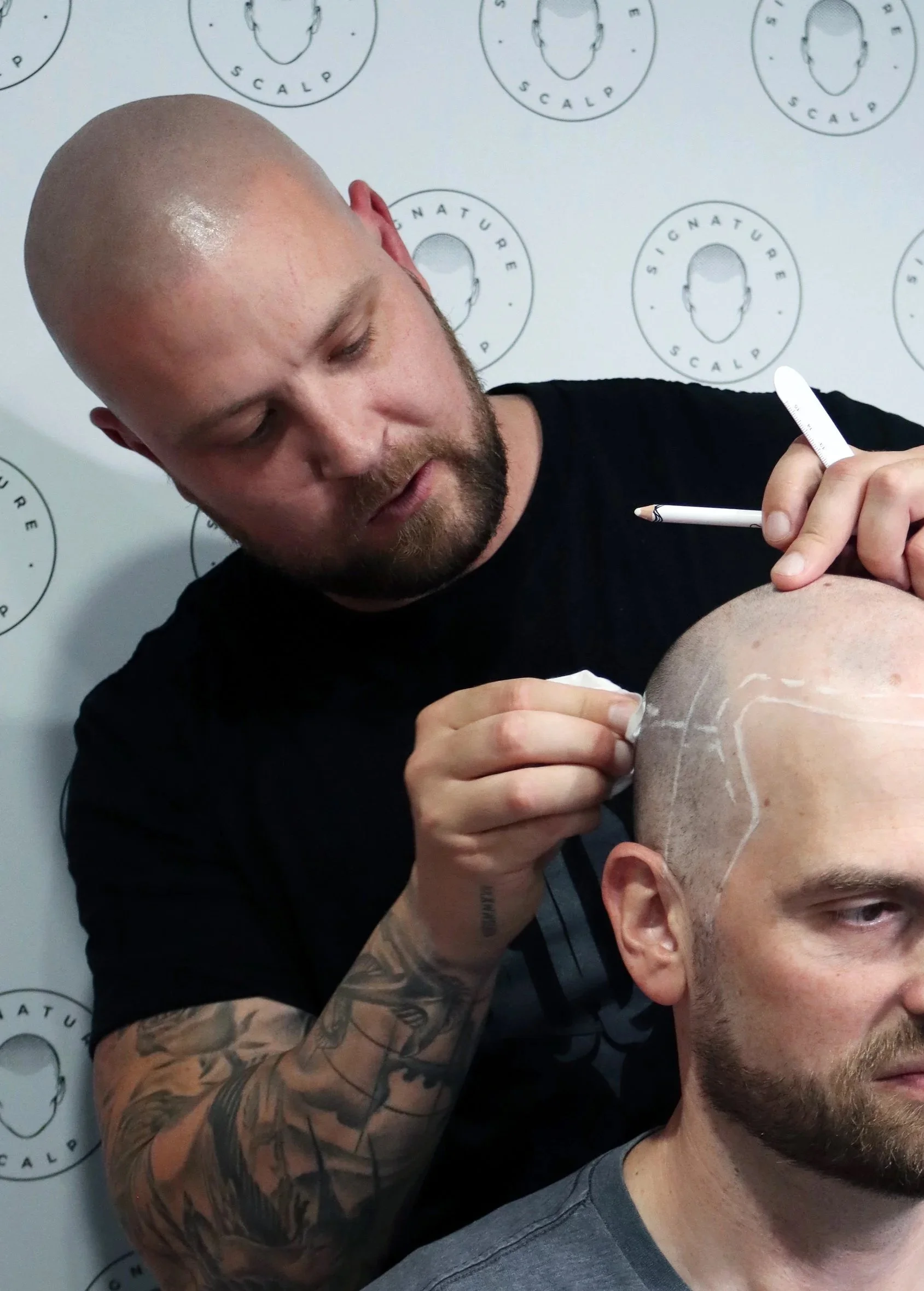 What is Scalp Micropigmentation?