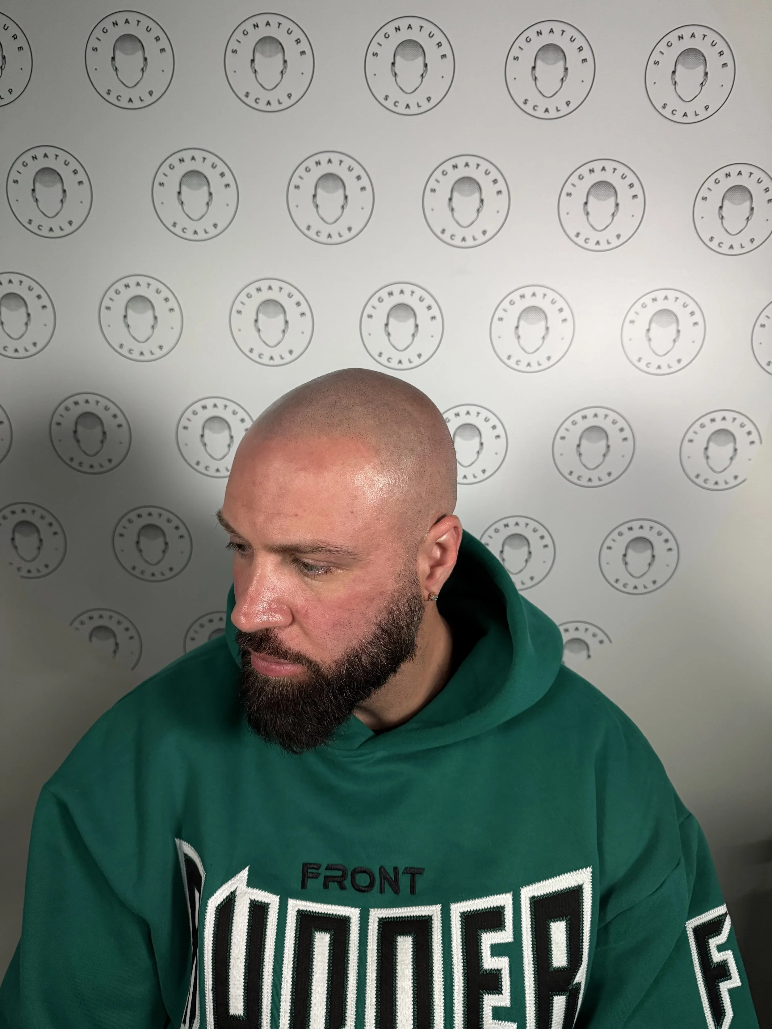 A side view of redarkened SMP