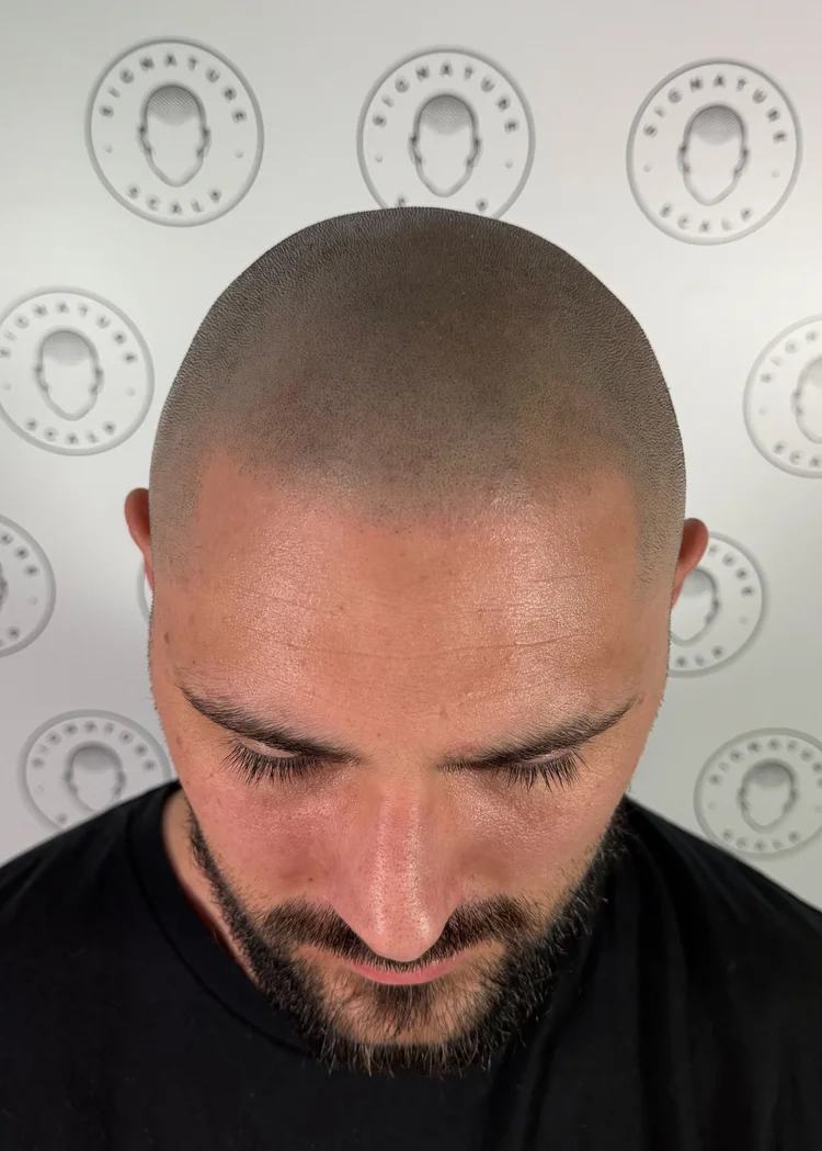 SMP shaved-head result, Adelaide