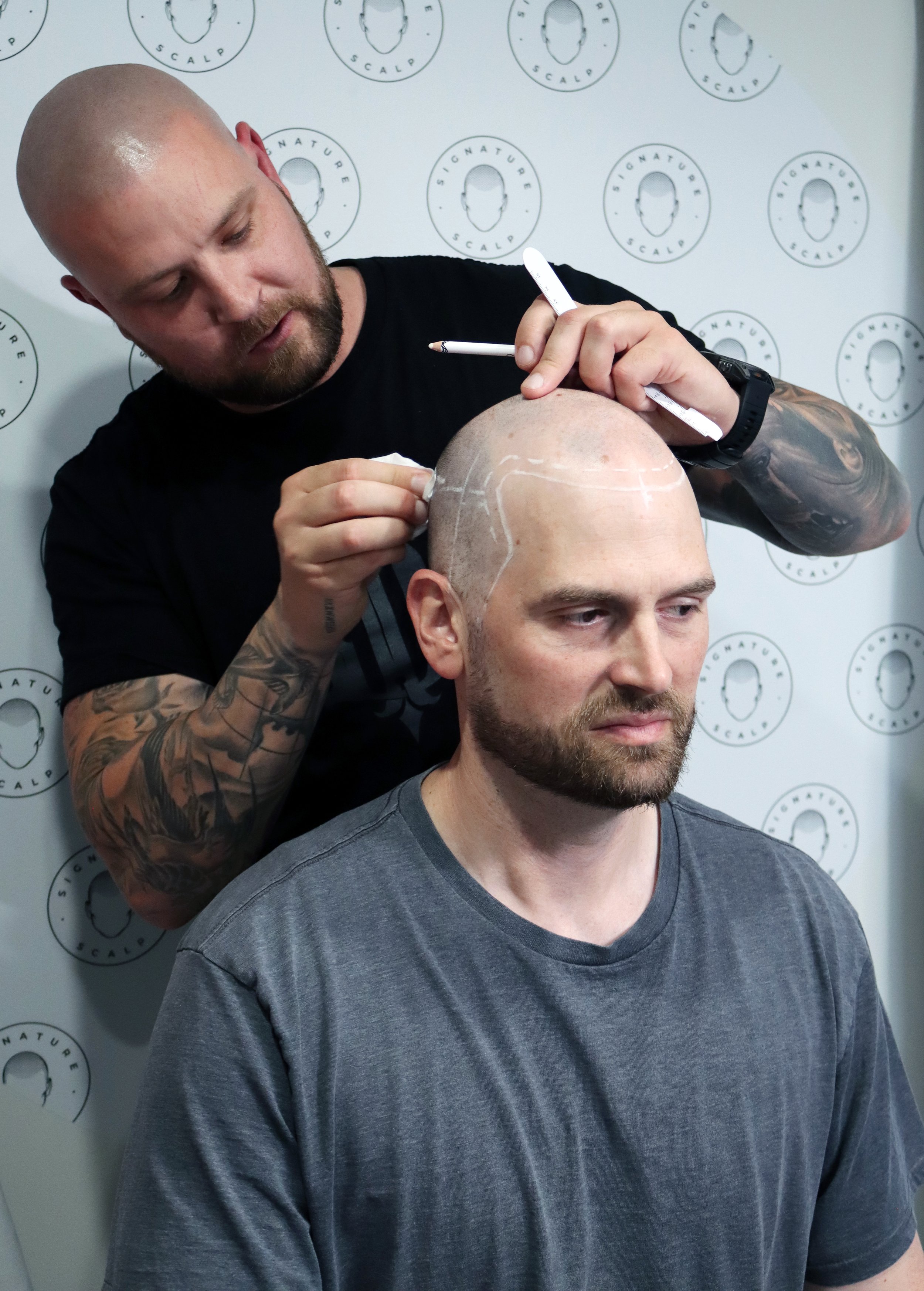 Signature Scalp Adelaide SMP artist drawing natural hairline on male client during scalp micropigmmentation treatment