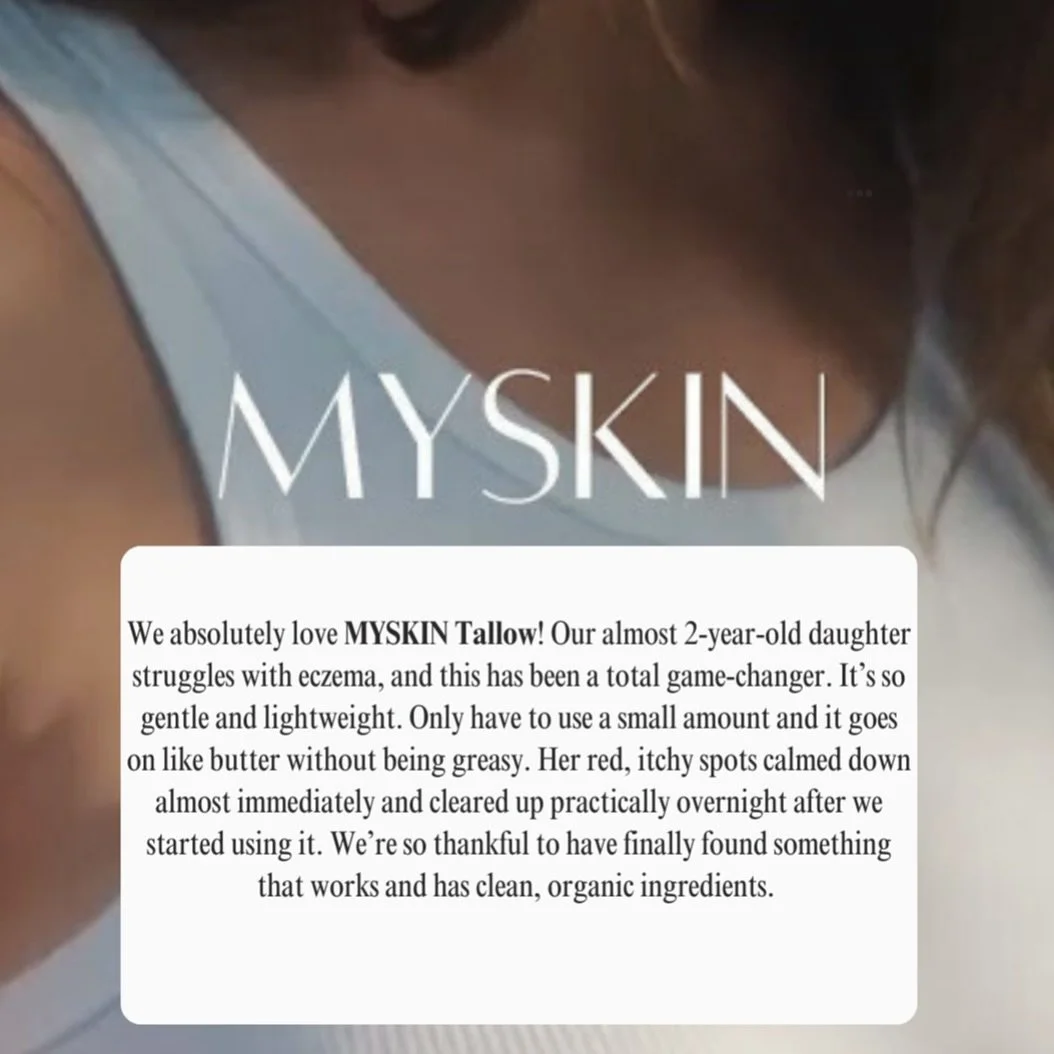 Our tallow has helped people of all ages. Developing a product that can help anyone is nothing short of amazing! 

#tallowskincare #tallowbalm #organicskincare #organic #goodskin #healthyskin #organicskincareproducts #nontoxicskincare #wichitabusines
