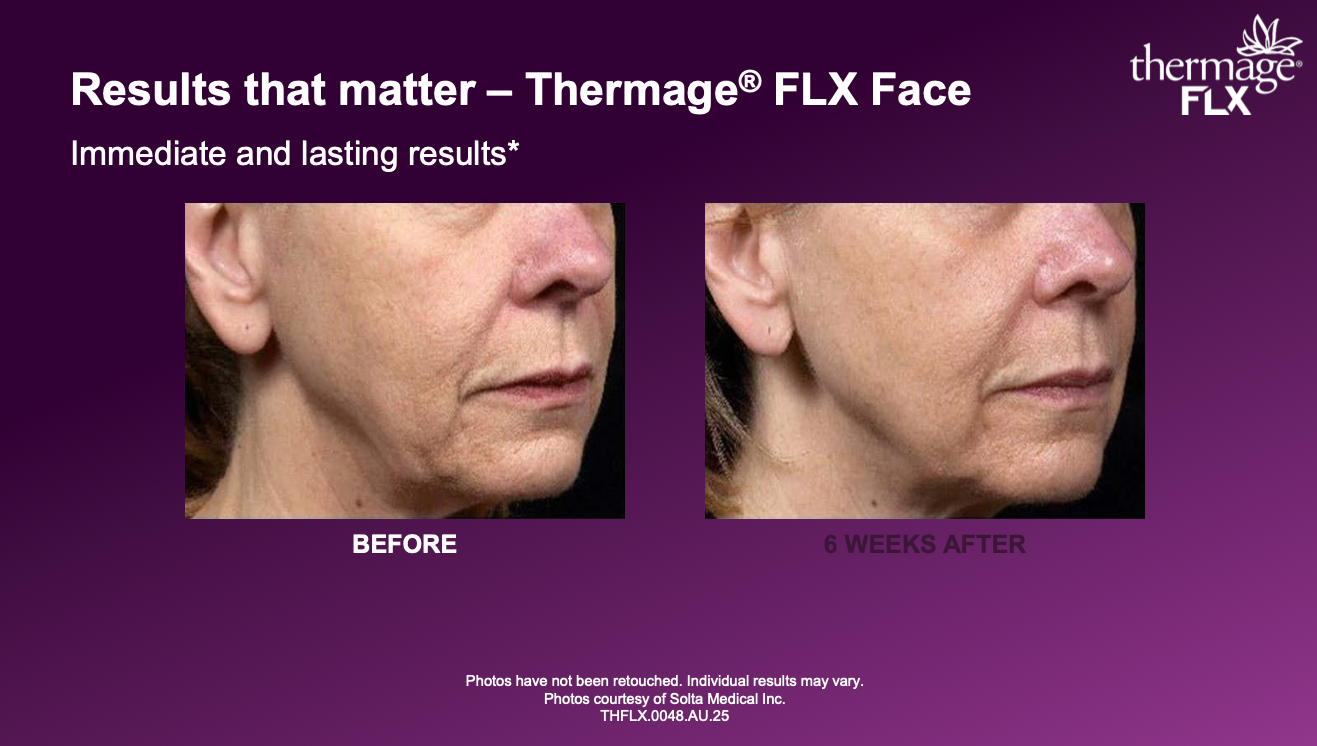 Screenshot 2026-01-23 at 9.28.49 am.png