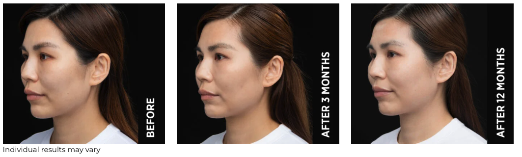 Screenshot 2026-01-23 at 9.27.55 am.png