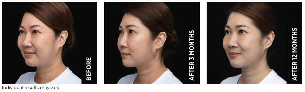 Screenshot 2026-01-23 at 9.27.40 am.png