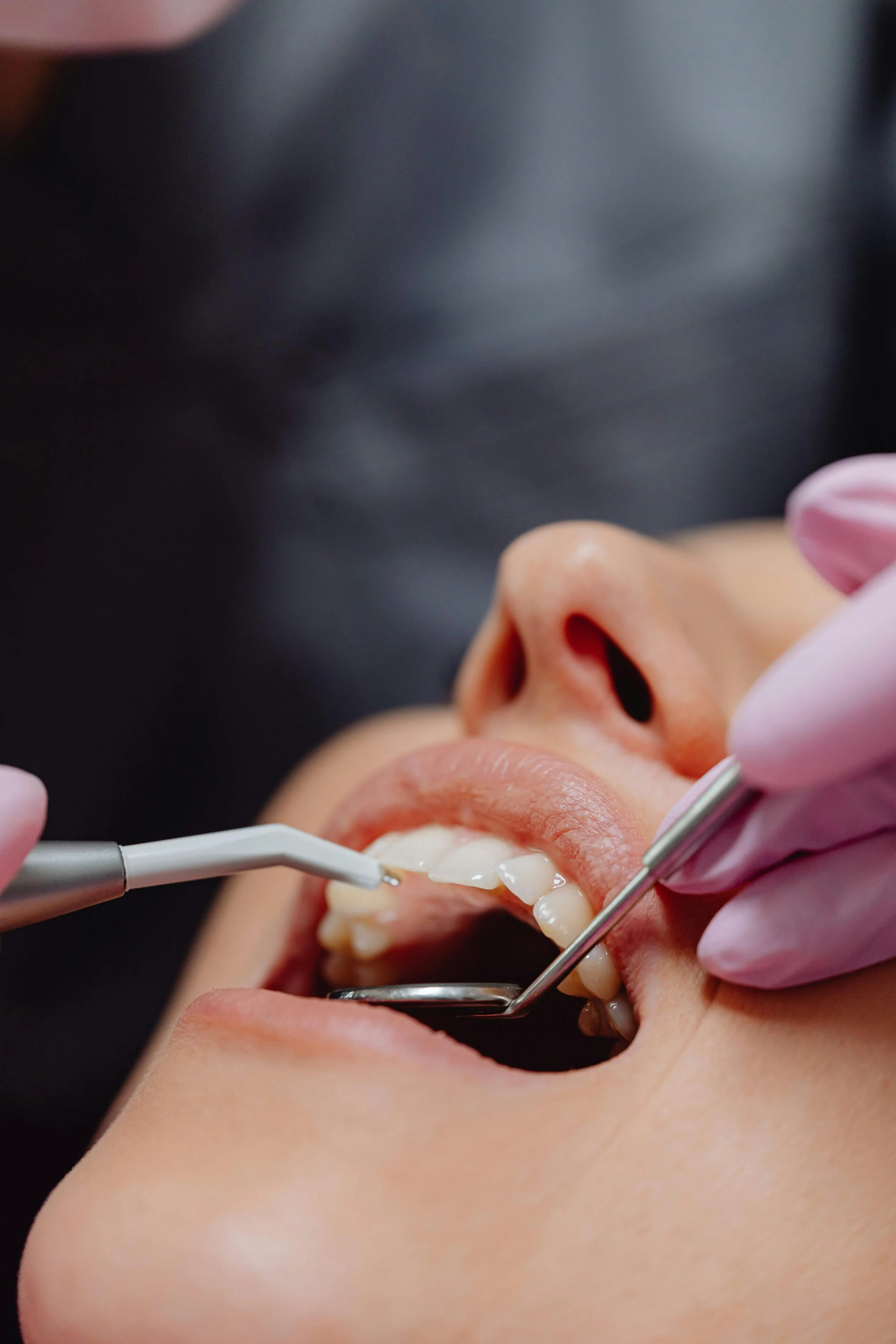 Close-up of a person receiving dental cleaning or examination using dental tools, with the person's mouth open and dentist's gloved hands visible.